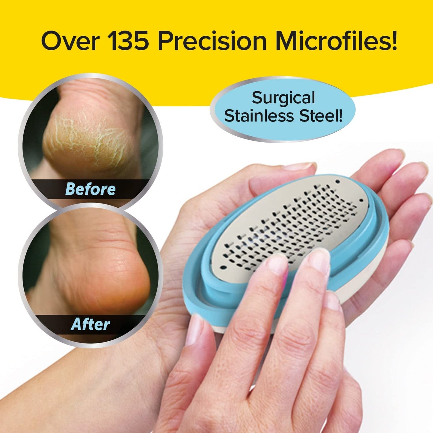 PedEgg Foot File, Painless Callus Remover, Mess-Free, As Seen on TV Beauty and Personal Care Ped Egg