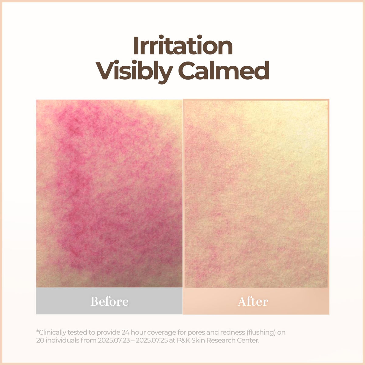 Cell Fusion C Skin Blemish Balm No.32 Mocha - Medium-Tan with Warm Undertone, Lightweight BB Cream with Ceramide, Tinted Moisturizer for Sensitive Beauty and Personal Care Cell Fusion C