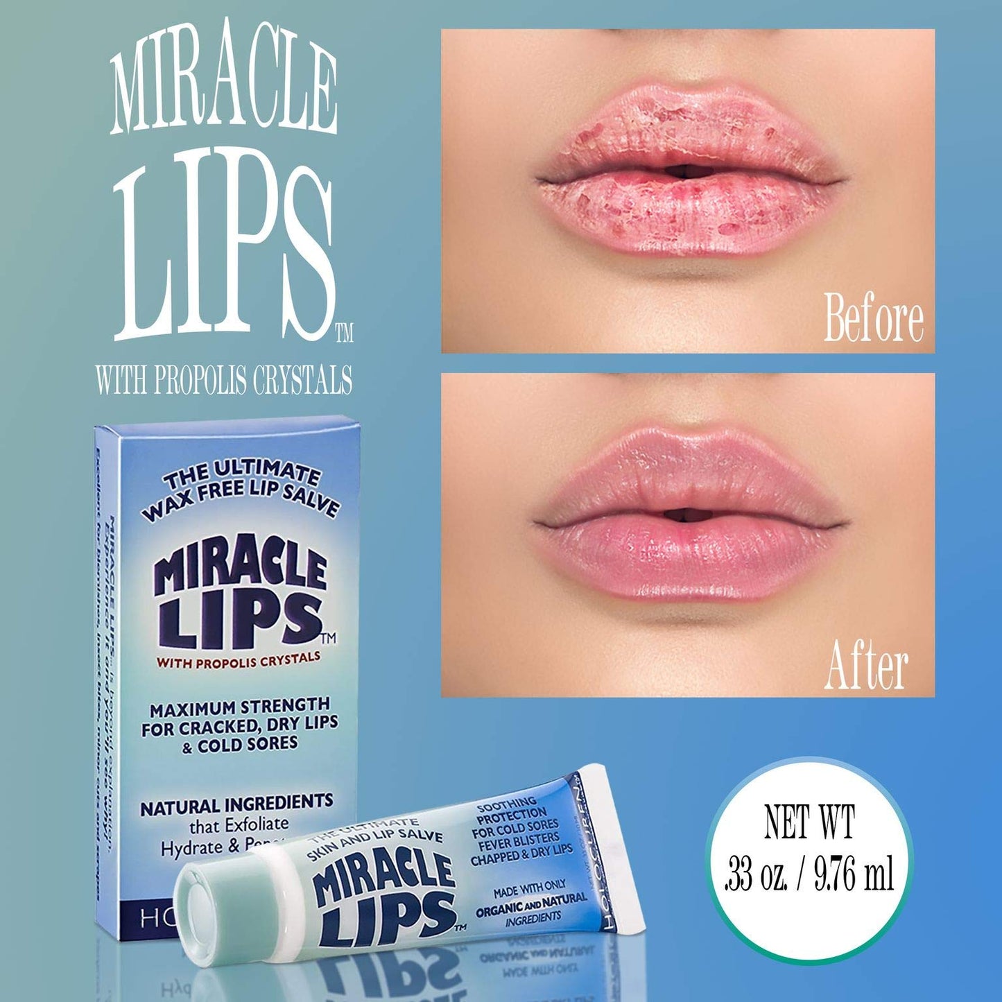 Holocuren Miracle Lips Salve, 0.33 Ounce