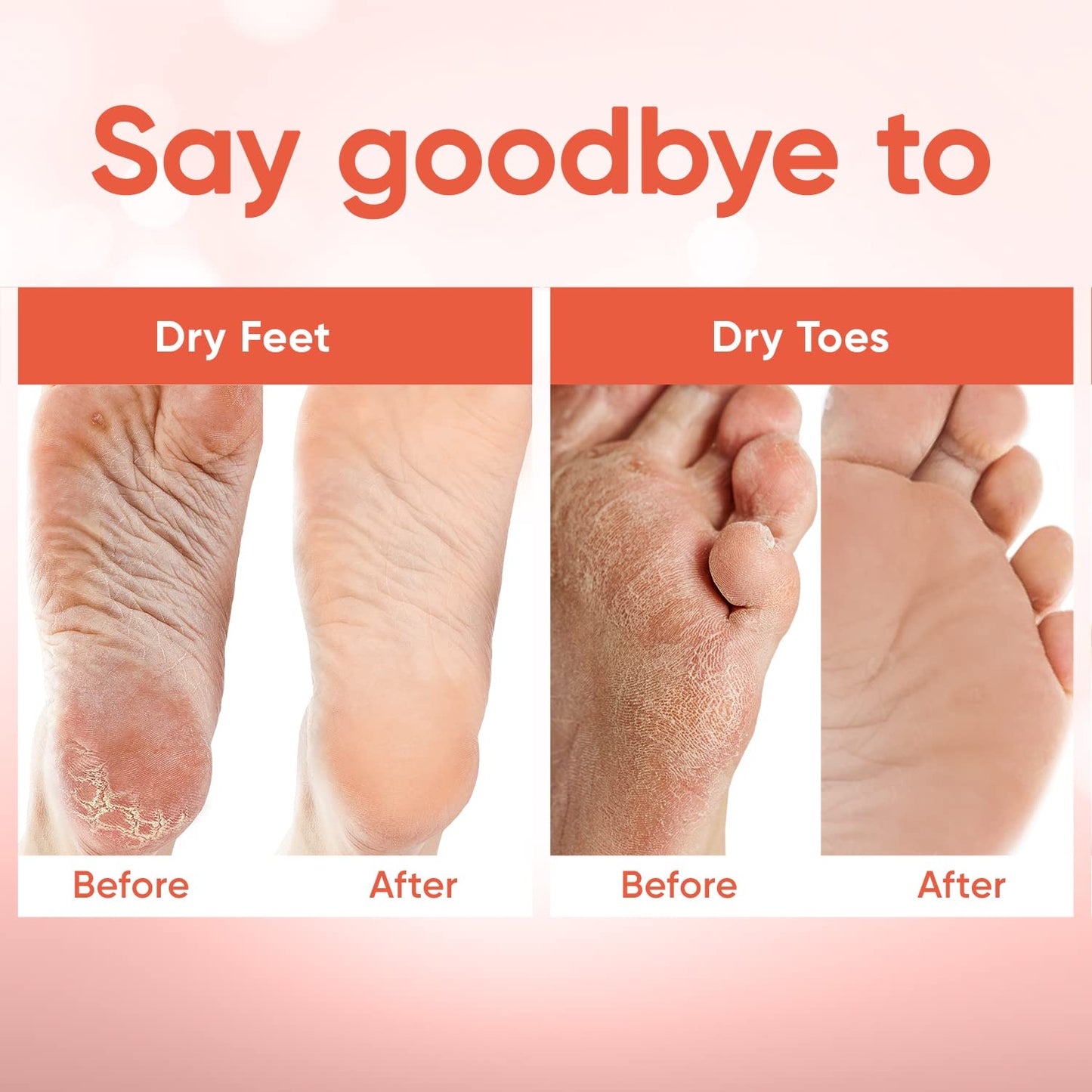 CÉLOR Foot Peeling Mask for Dry Cracked Feet | Foot Mask to Exfoliate Rough, Cracked, Dry Feet, Calluses for Soft Baby Feet Results | Made with Aloe Beauty and Personal Care CÉLOR