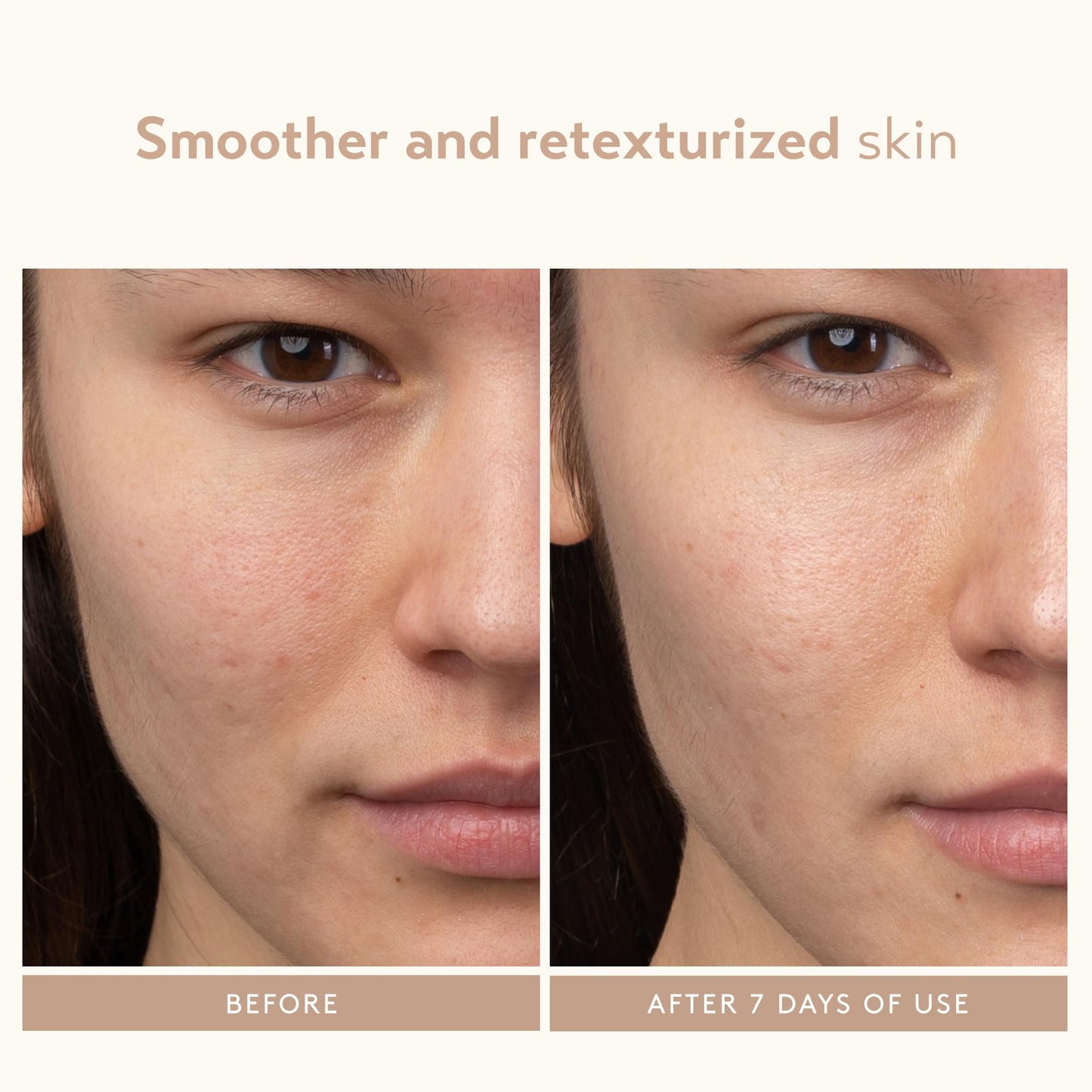 SHANI DARDEN SKIN CARE Lactic Acid Face Serum Travel Size, Active Night Serum to Help with the Look of Radiant and Smooth Skin, Gentle But Powerful