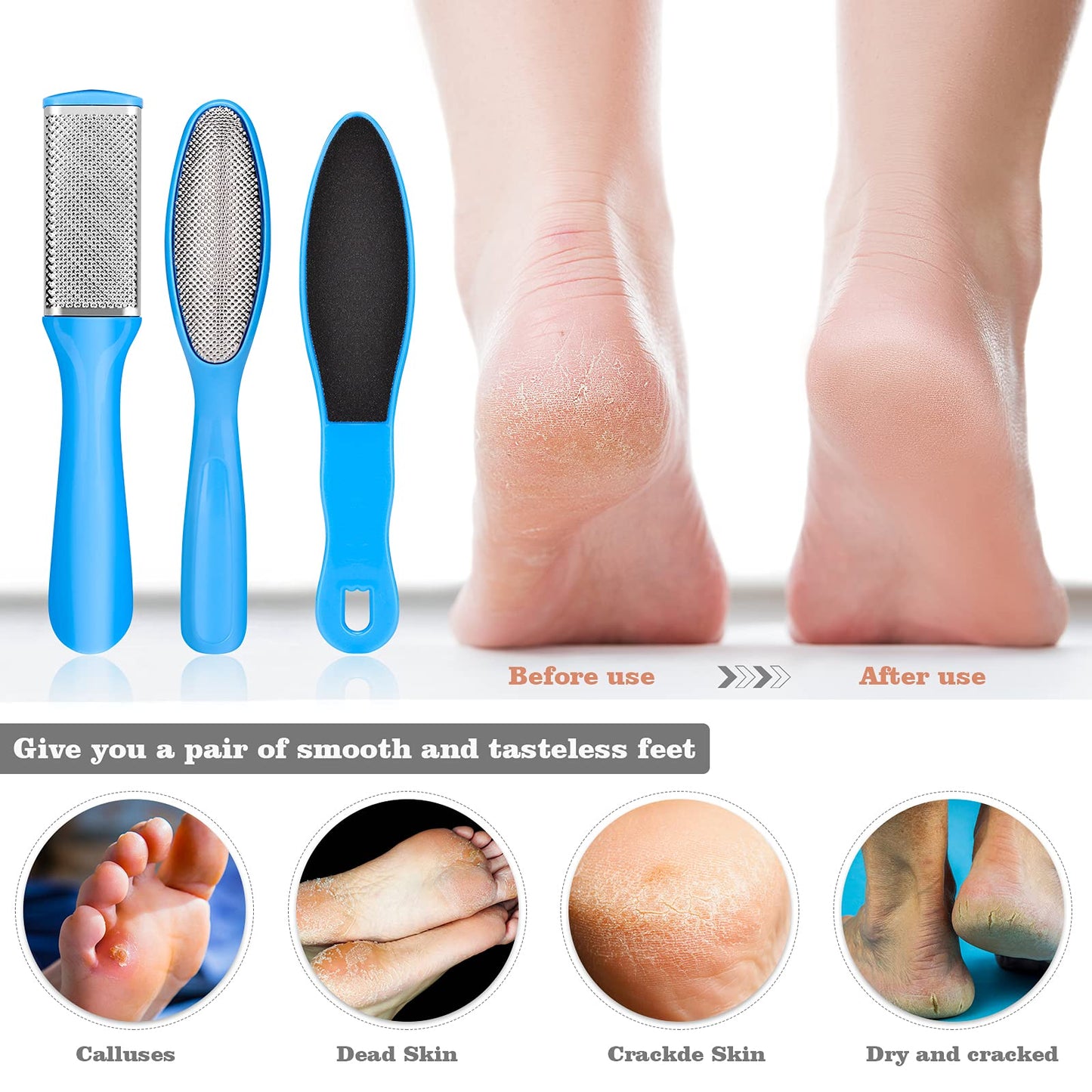 Pedicure Kits - Callus Remover for Feet, 23 in 1 Professional Manicure Set Pedicure Tools Stainless Steel Foot Care, Foot File Foot Rasp Dead Skin