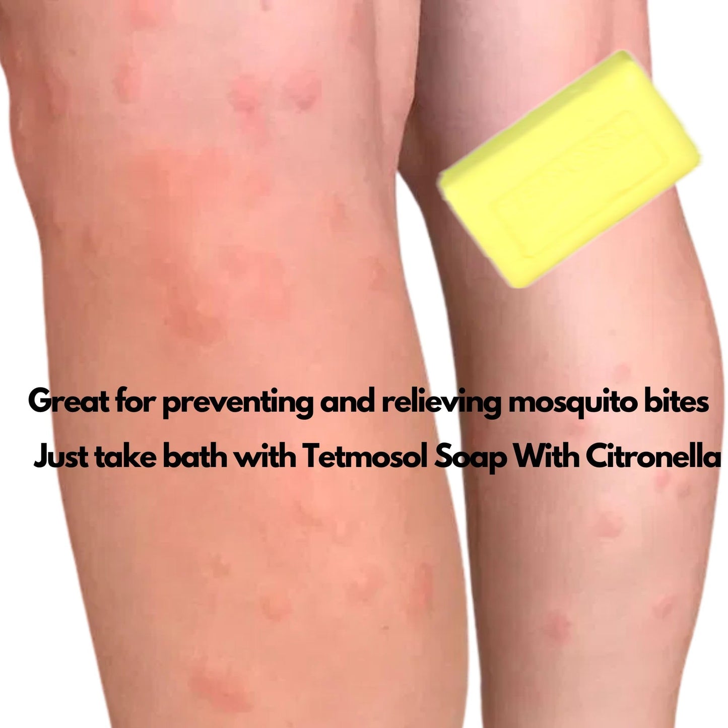 NatoGears Tetmosol Medicated Soap With Citronella Pack (2)