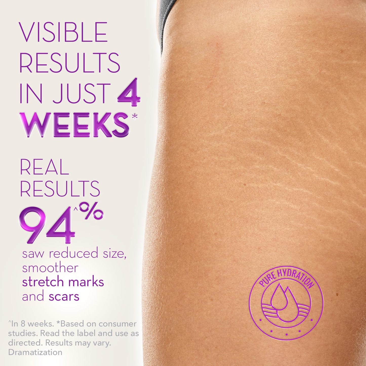 Cicatricure Cica Oil for Stretch Marks & Scars, Visible Results in 4 Weeks, Pregnancy Must-Haves Body Oil with Vitamin E, Stretch Mark Oil, Scar Beauty & Personal Care Cicatricure