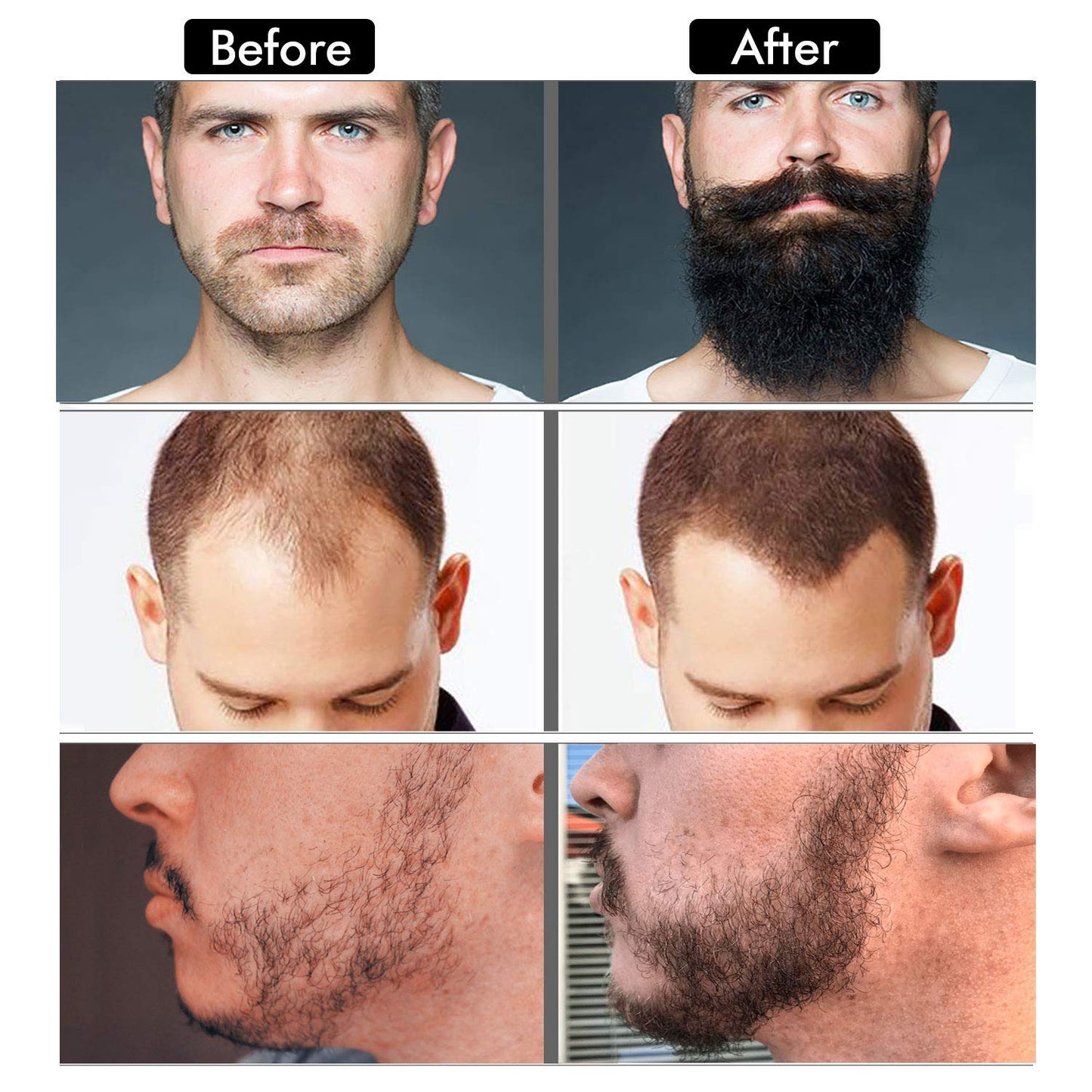 Beard Growth Kit - Beard Kit for Men, Beard Growth Oil (2oz), Beard Balm, Beard Comb, Massager for Spot/Patchy Beard - Christmas, Anniversary