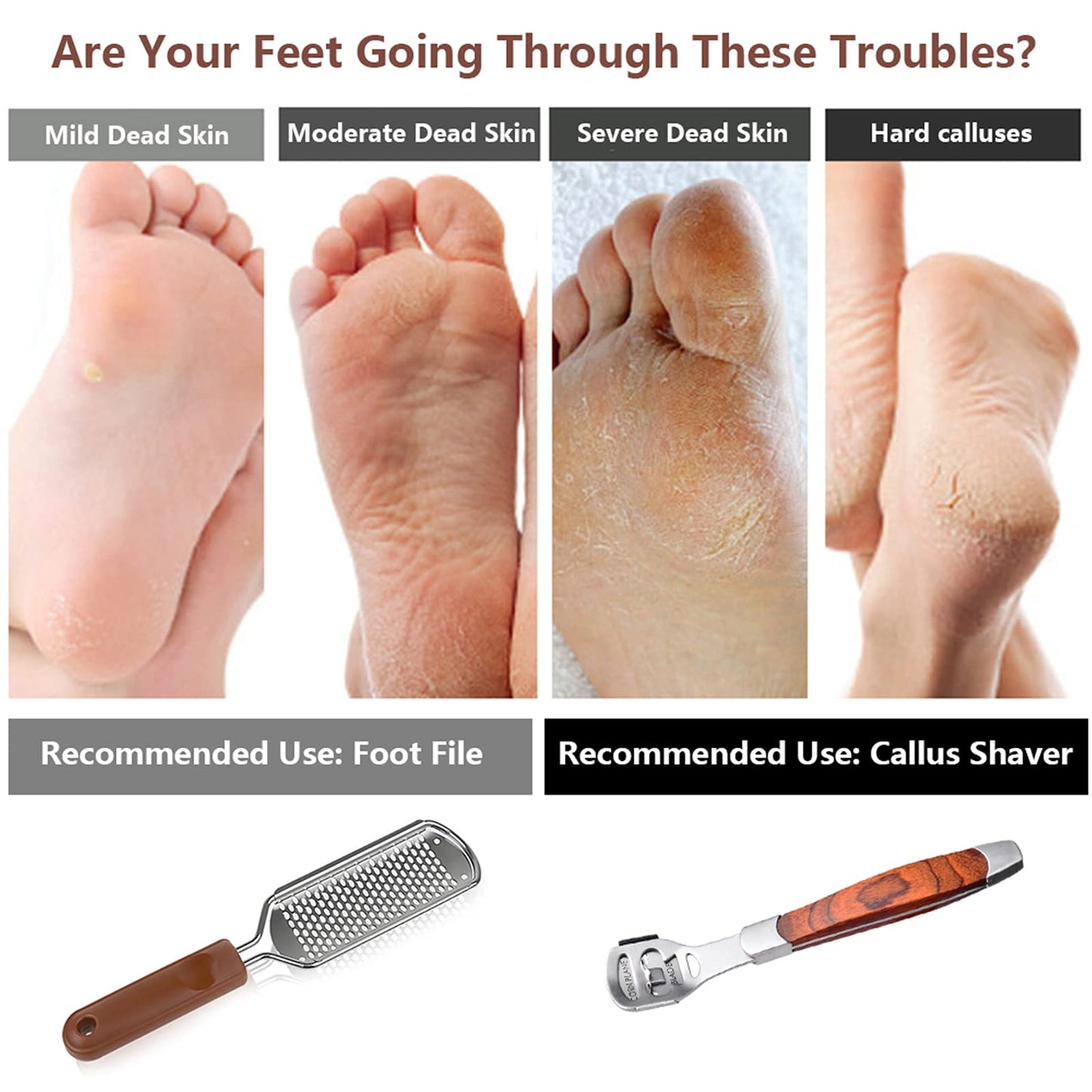 Colossal Foot Rasp & Wood Handle Callus Shaver (10 Replacement & 1 File Foot Heads), Pedicure Foot File Kit, Heel Scraper for Feet, Foot File Callus Beauty and Personal Care Vusoset