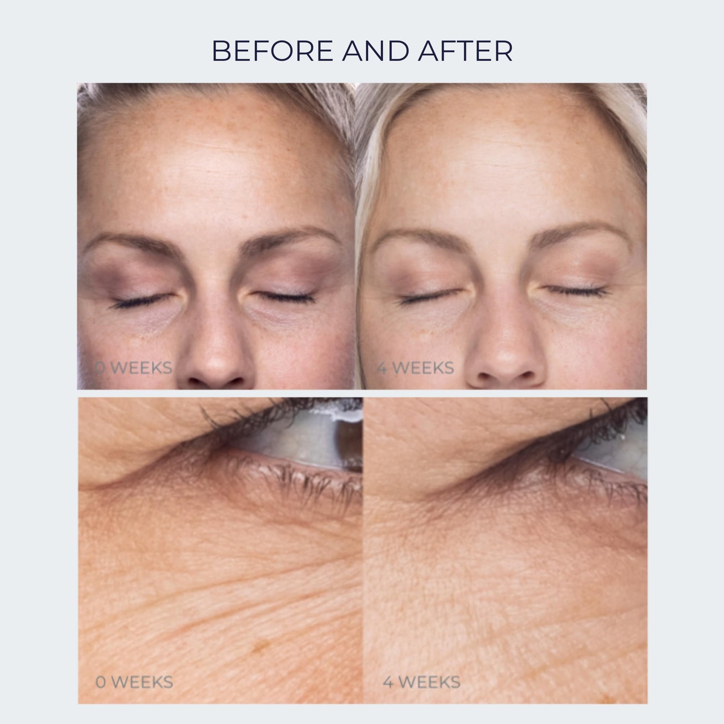 Anti-Aging Peptide Under Eye Cream - Peptide Eye Cream for Hydrated & Firm Skin - Under Eye Cream for Dark Circles and Puffiness - Anti Aging Eye