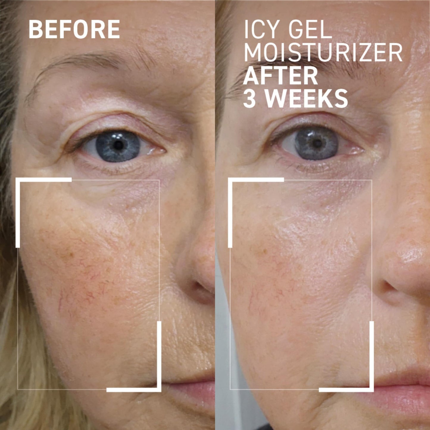 Dr. Brandt iD-STRESS Icy Gel Moisturizer - Revitalize Dull-Looking Skin for a Flawless, Dewy Complexion - 1.7 fl oz