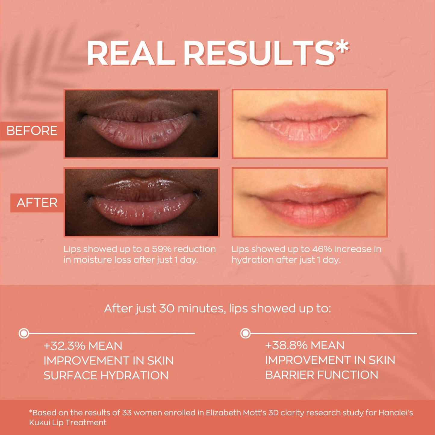 Hanalei Hydrating Lip Treatment Balm - Cruelty-Free, Paraben-Free Moisturizer for Severely Dry, Chapped Lips - Kukui Oil, Shea Butter & Grapeseed Oil