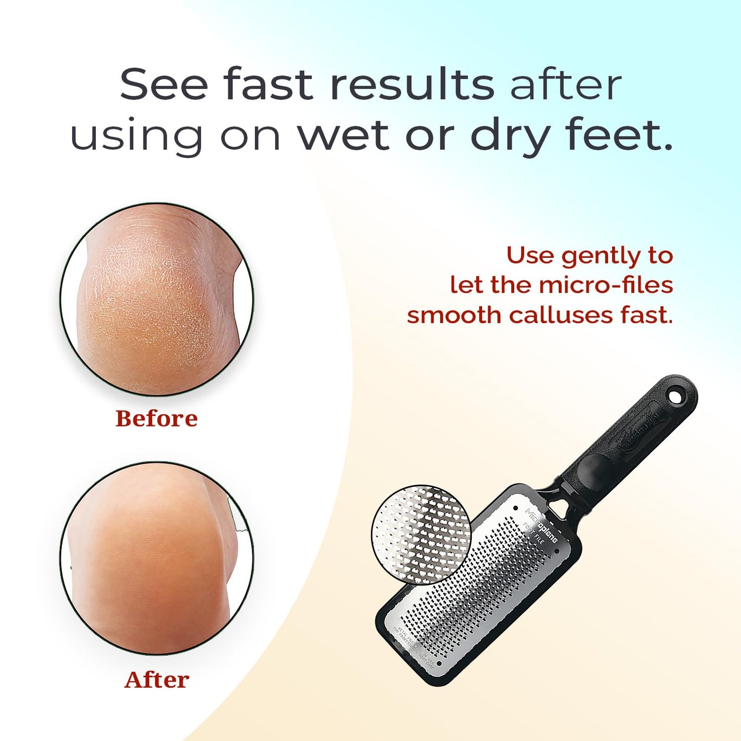 Microplane Colossal Foot File Scraper - The Original Stainless Steel Foot Rasp, Dead Skin/Callus Remover for Feet, Gentle Foot Scrubber, Pedicure
