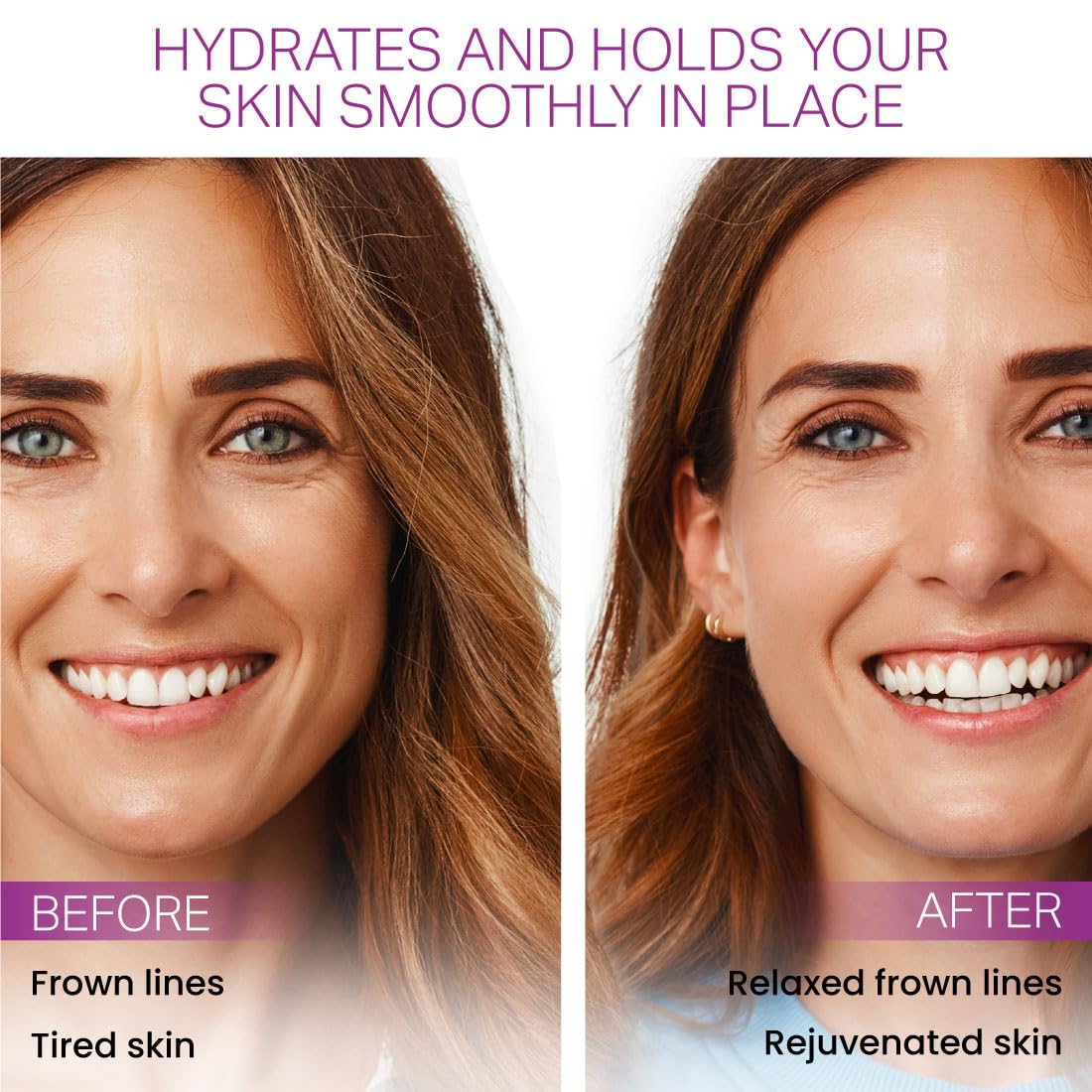 Furlesse Elevens Wrinkle Patches – 30 Non-Invasive Overnight Anti-Wrinkle Patches for Frown Lines, Anti-Aging Skincare, 30-Day Supply