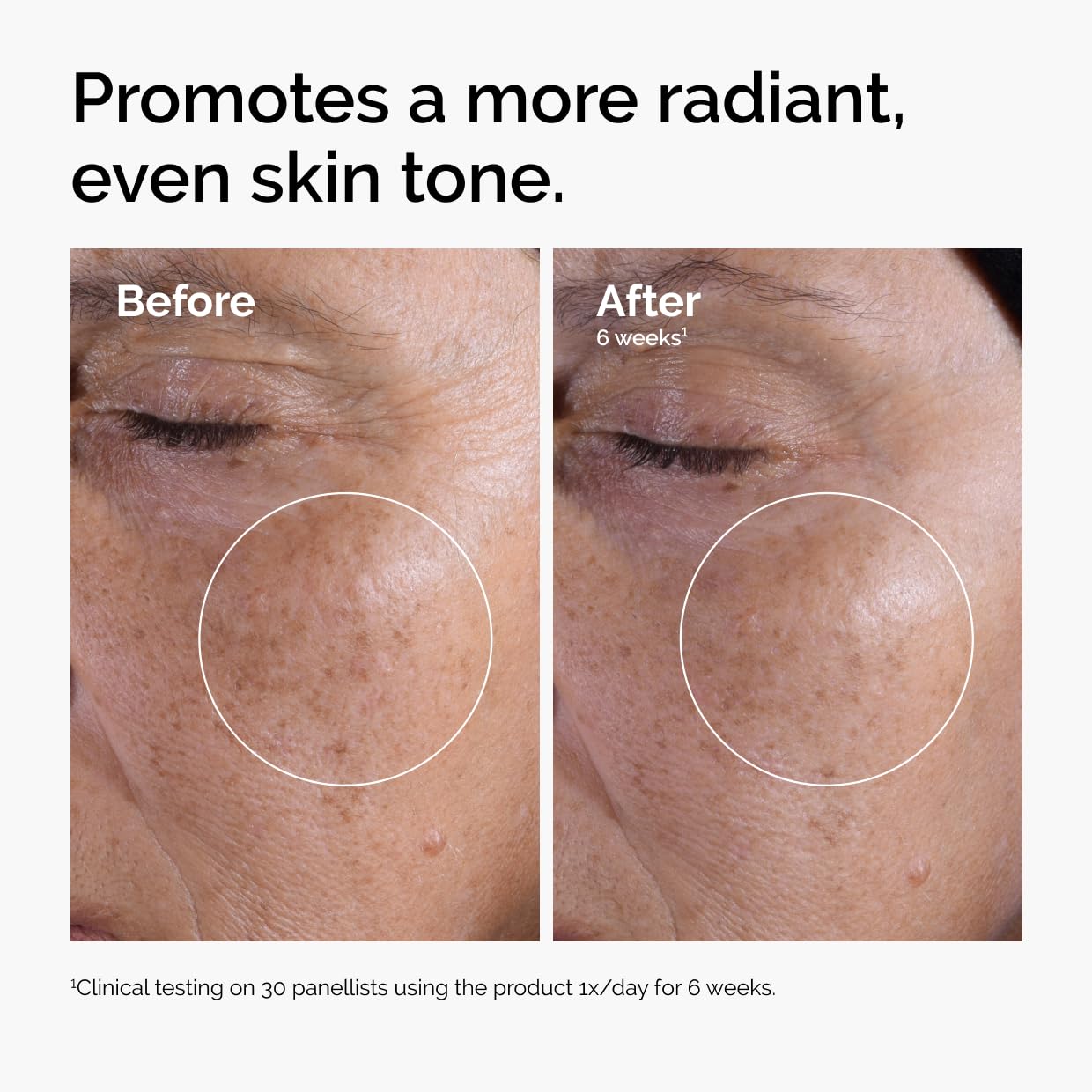 The Ordinary Glycolic Acid 7% Exfoliating Toner, Brightening and Smoothing Daily Toner for More Even-Looking Skin Tone, 8.1 Fl Oz Beauty and Personal Care The Ordinary