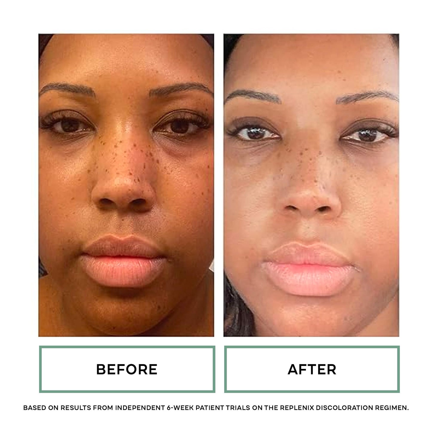 Replenix Vitamin C Pro Collagen Serum, Brightening Anti-Aging Face Treatment with Medical-Grade Antioxidants for Skin Discoloration (1 fl. oz)