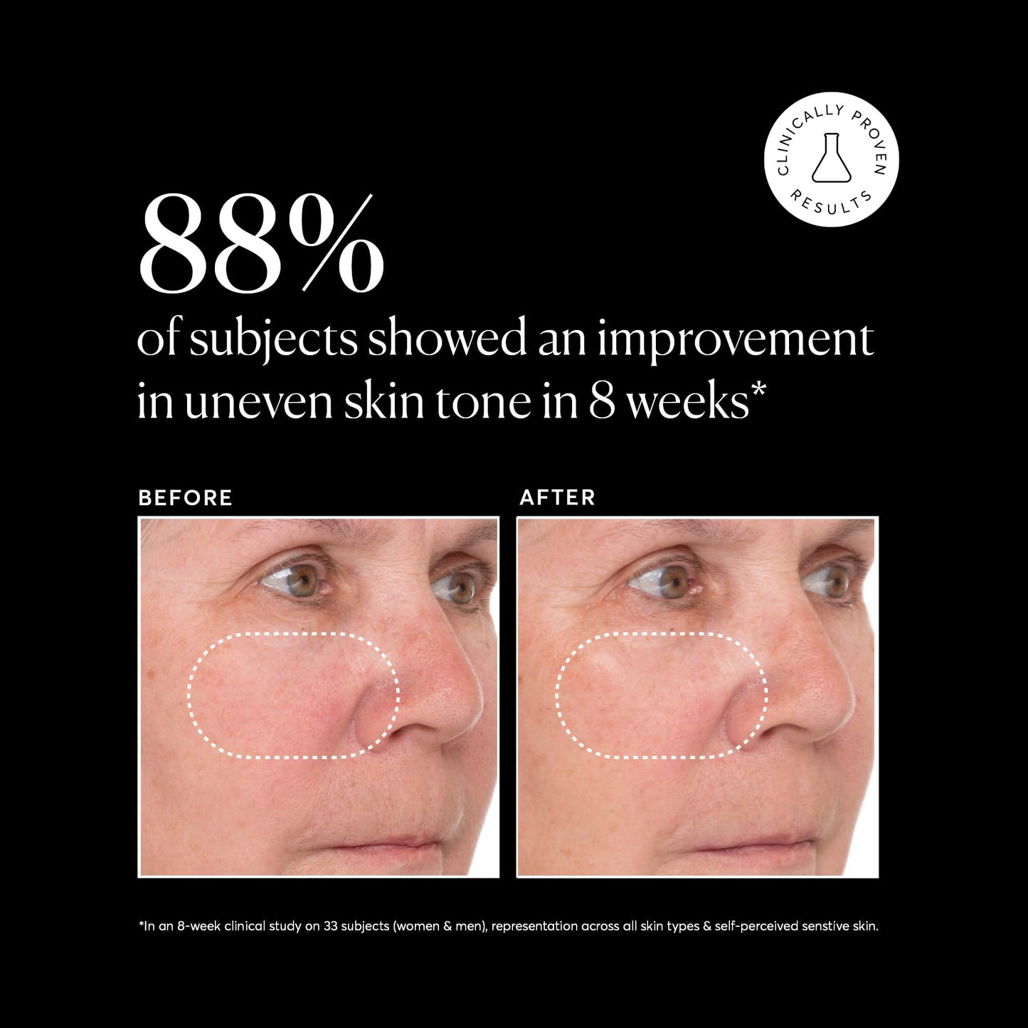 Naturium Vitamin C Super Serum Plus, Smoothing Face Care, plus Retinol, Hyaluronic Acid, Niacinamide & Salicylic Acid, 1 oz