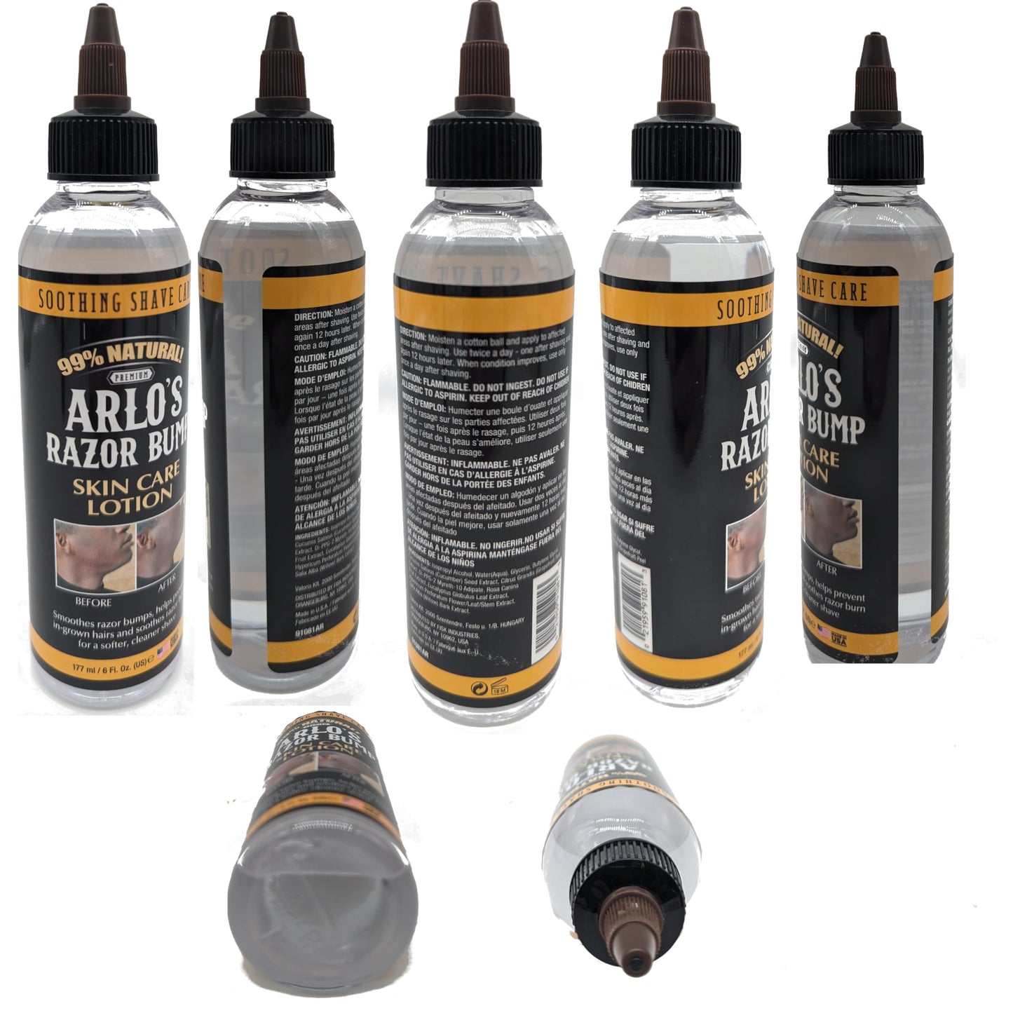 Arlo's Razor Bump Skin Care Lotion 6 oz.