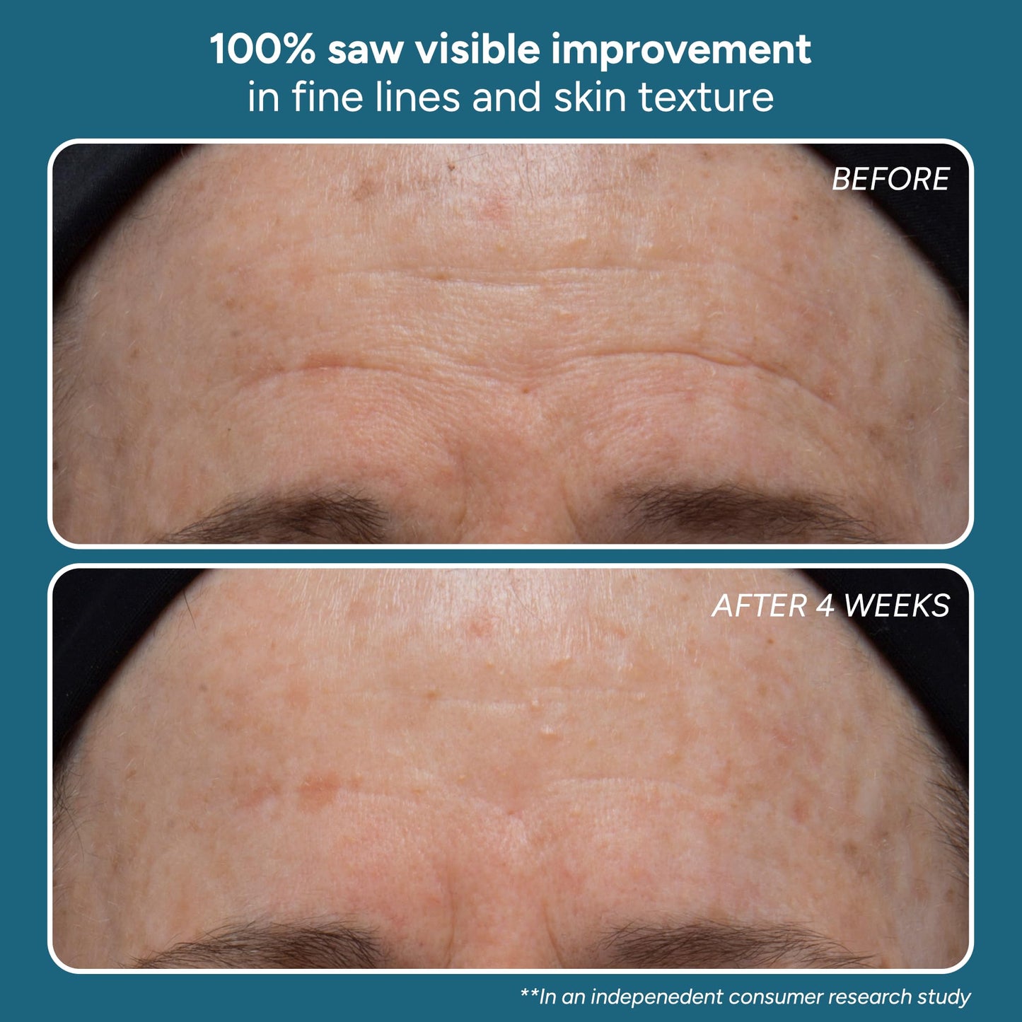 Lancer Skincare | The Method: Cleanse Face Cleanser | Salicylic Acid Face Wash | Gentle Daily Cleanser for Normal or Combination Skin | Pore Cleansing