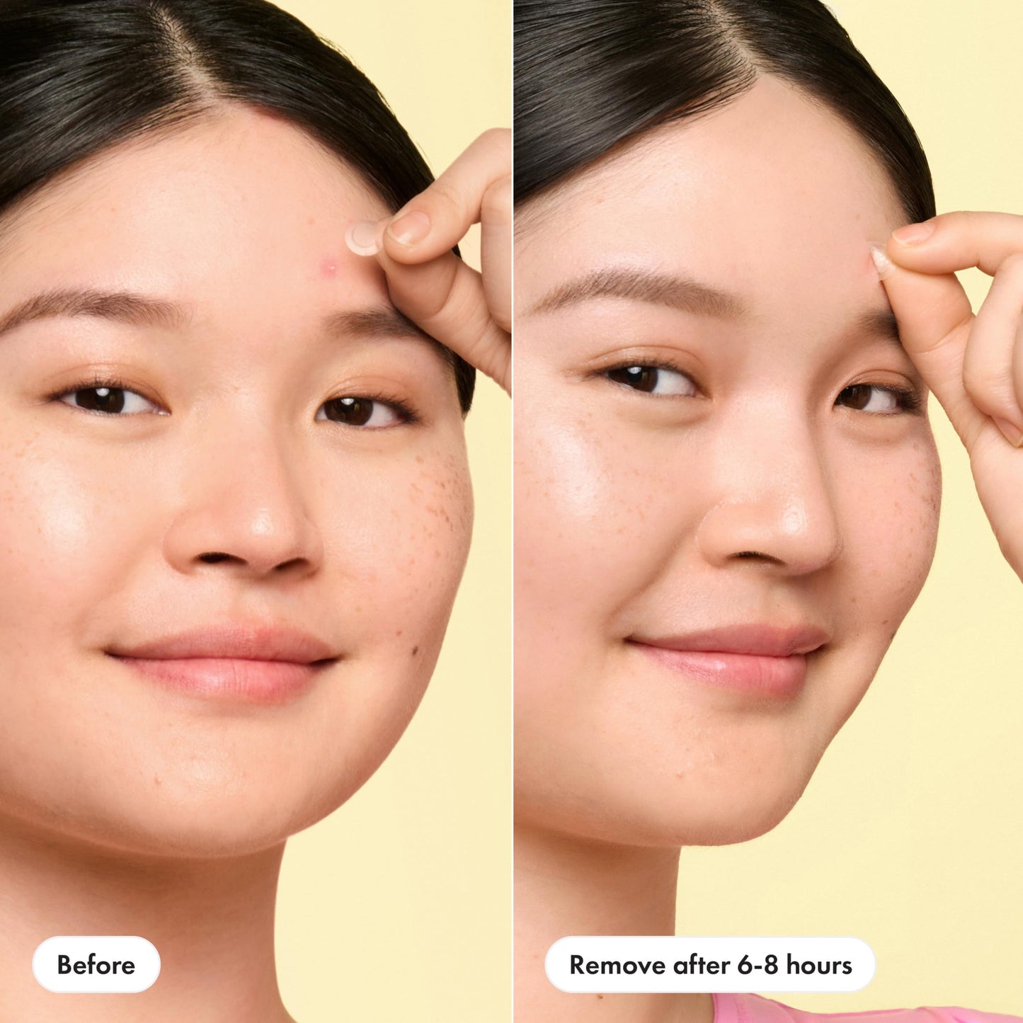 Hero Cosmetics Mighty Patch Mini Invisible+ Acne Pimple Patches, 30 Ct Beauty and Personal Care Mighty Patch