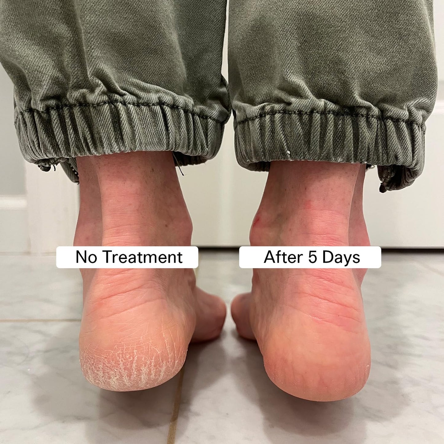 Pedestrian Project Cracked Heel Repair Foot Care Balm, Smooths & Fills Cracks & Rough Skin with Healing Shea & Mango Butters, Vegan, Cruelty Free, 1