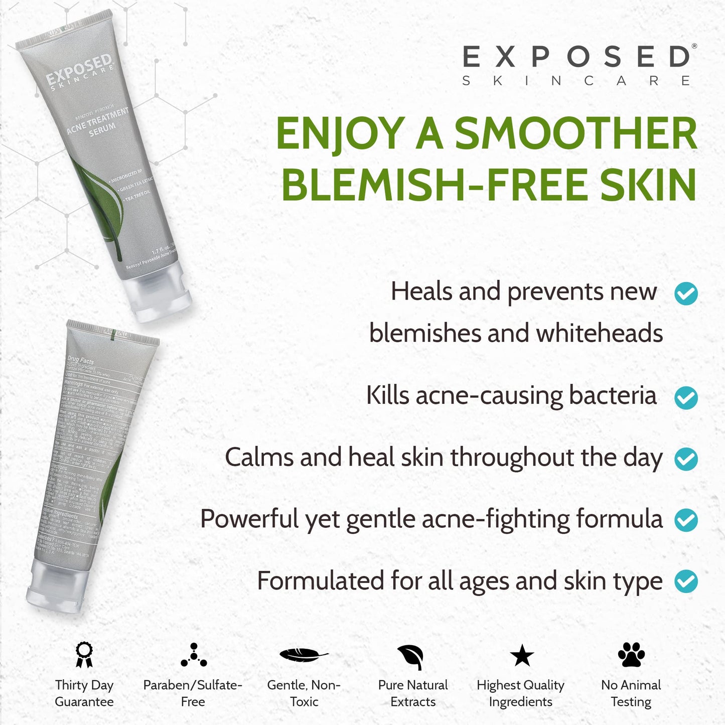 Exposed Skin Care, Acne Treatment Serum with 3.5% Benzoyl Peroxide - Lightweight Acne Spot Treatment - Quickly Clear Teen, Adult, Hormonal and Cystic