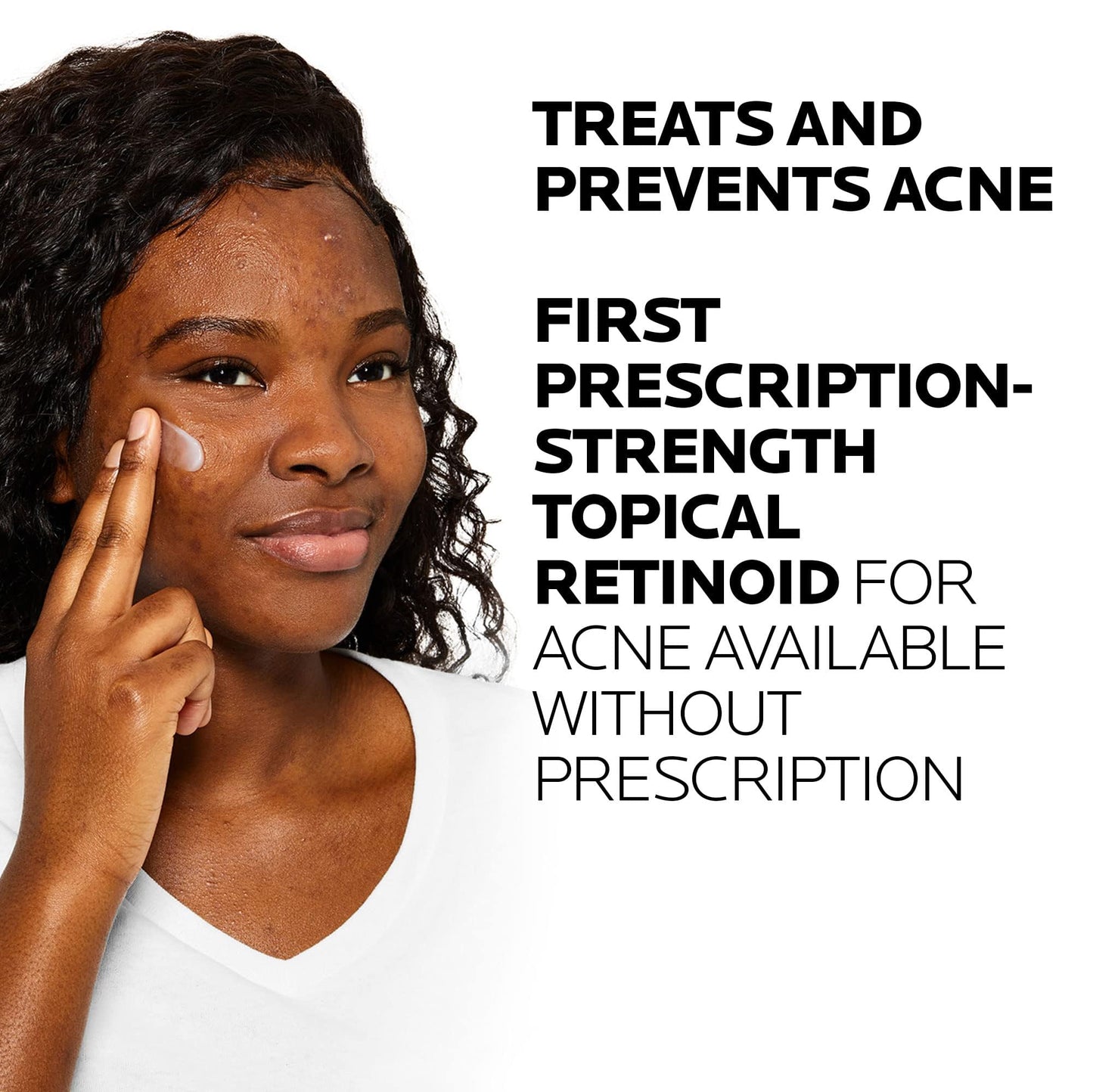 La Roche-Posay Effaclar Adapalene Gel 0.1% Acne Treatment, Retinoid Cream, Acne Medication Gel for Blackheads & Whiteheads, Oil Free, Helps Clear Beauty and Personal Care La Roche-Posay