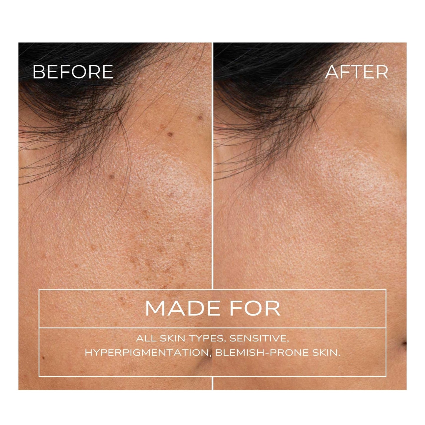 Fitglow Beauty Clear + Bright Mandelic Serum Drops | Gentle Exfoliating Face Serum | Evens Tone, Corrects Discoloration & Clears Breakouts |