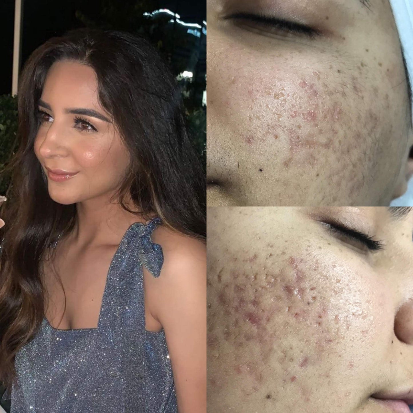 MT Skin Clinic Pro Advanced Hyaluronic Acid Serum for Face, Glow+ Antioxidant Protein-Rich Face Lift Serum with Vitamin C, Niacinamide and B5 for Dry