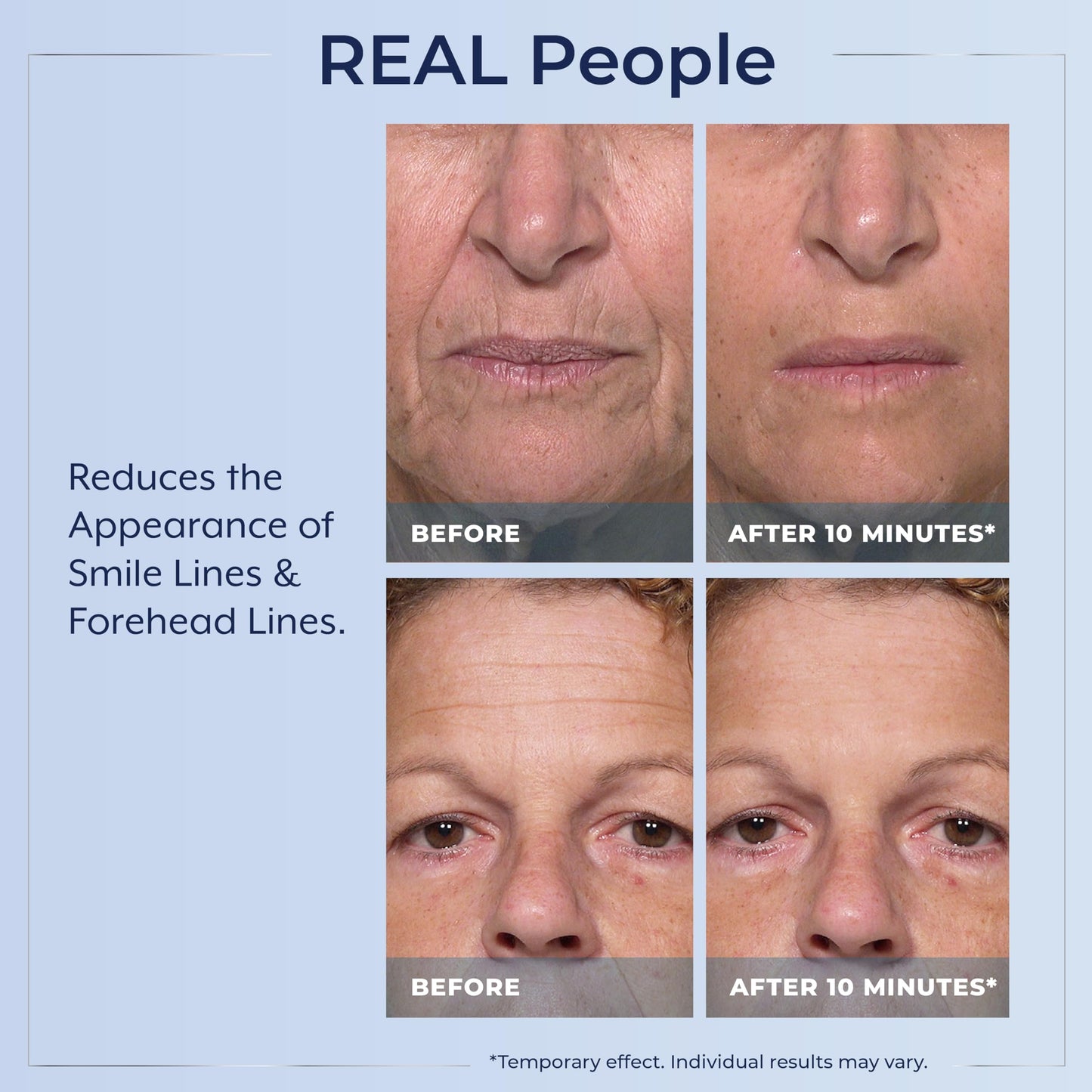 Plexaderm Rapid Reduction Eye Serum - Visibly Reduces Under-Eye Bags, Wrinkles, Dark Circles, Fine Lines & Crow's Feet Instantly, Anti Aging Wrinkle