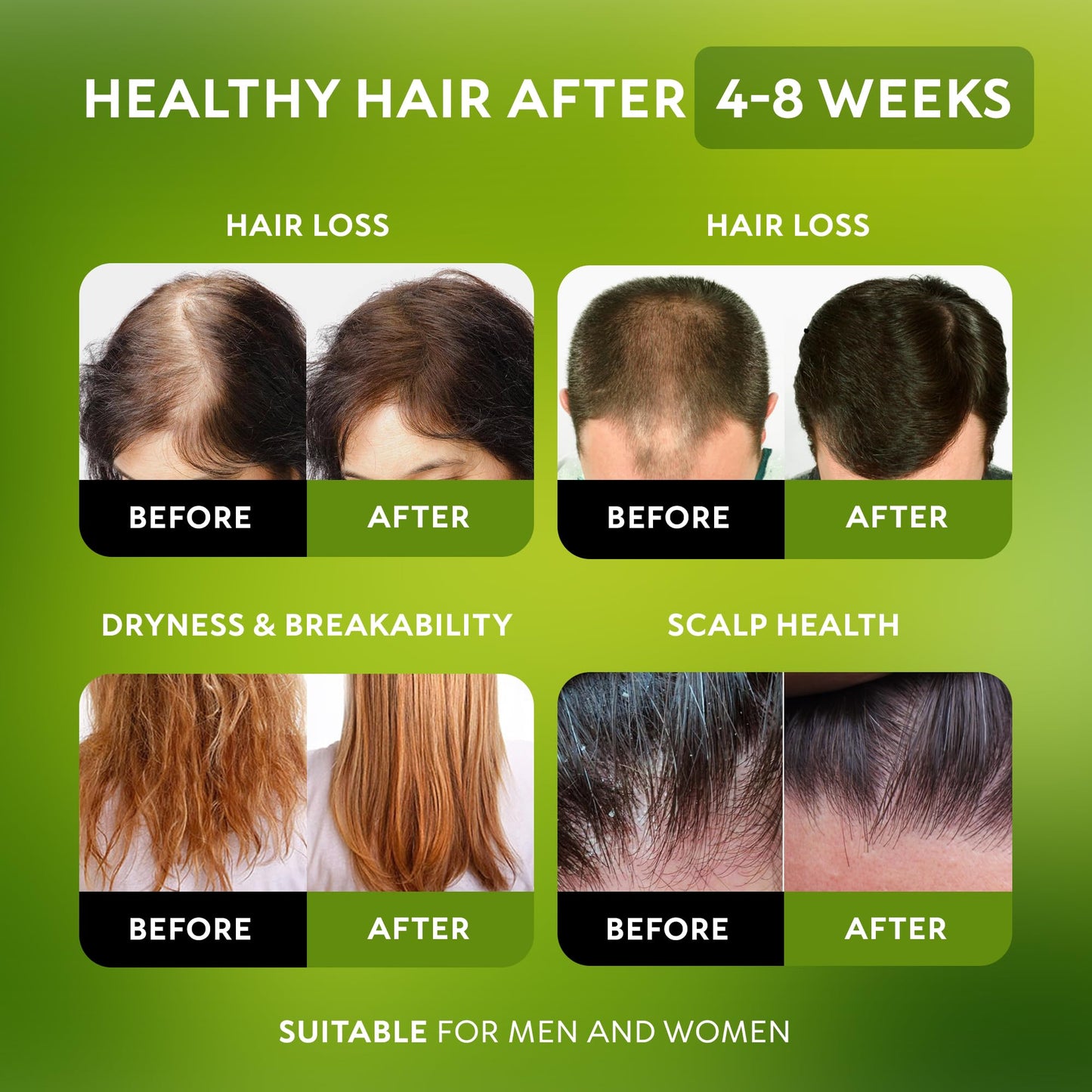Batana Oil for Hair Growth (21.2 Ounce (Pack of 1)) Beauty and Personal Care RICHGRAND
