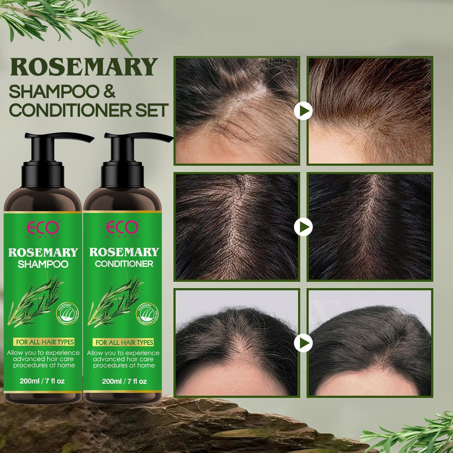 Rosemary Hair Growth Shampoo & Conditioner Set: Infused with Tea Tree Oil Mint Biotin - Cleanses and Helps Strengthen Weak and Brittle Hair - Promotes