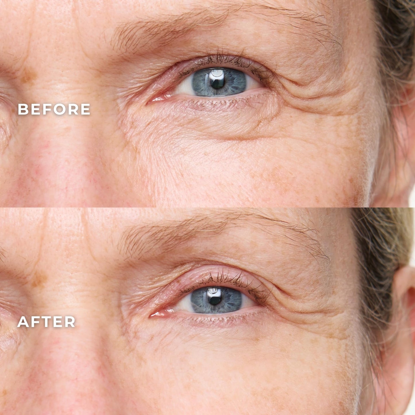 WUNDER2 Wunderlift Instant Eye Tightening Serum, Temporary Firming & Lifting Treatment in 60 Seconds, Reduces Under-Eye Bags, Dark Circles, Puffiness