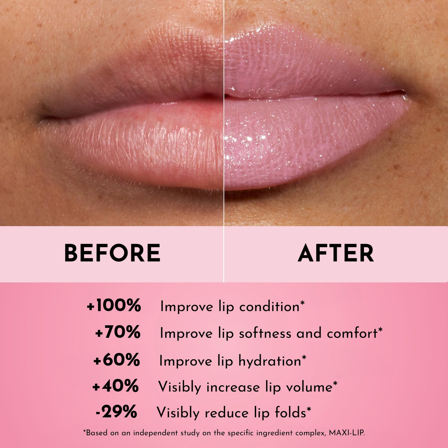 Lawless Forget the Filler Lip Plumping Line Smoothing Gloss - Daisy Girl - Premium Volumizing Lip Gloss with Natural Ingredients Designed to Plump