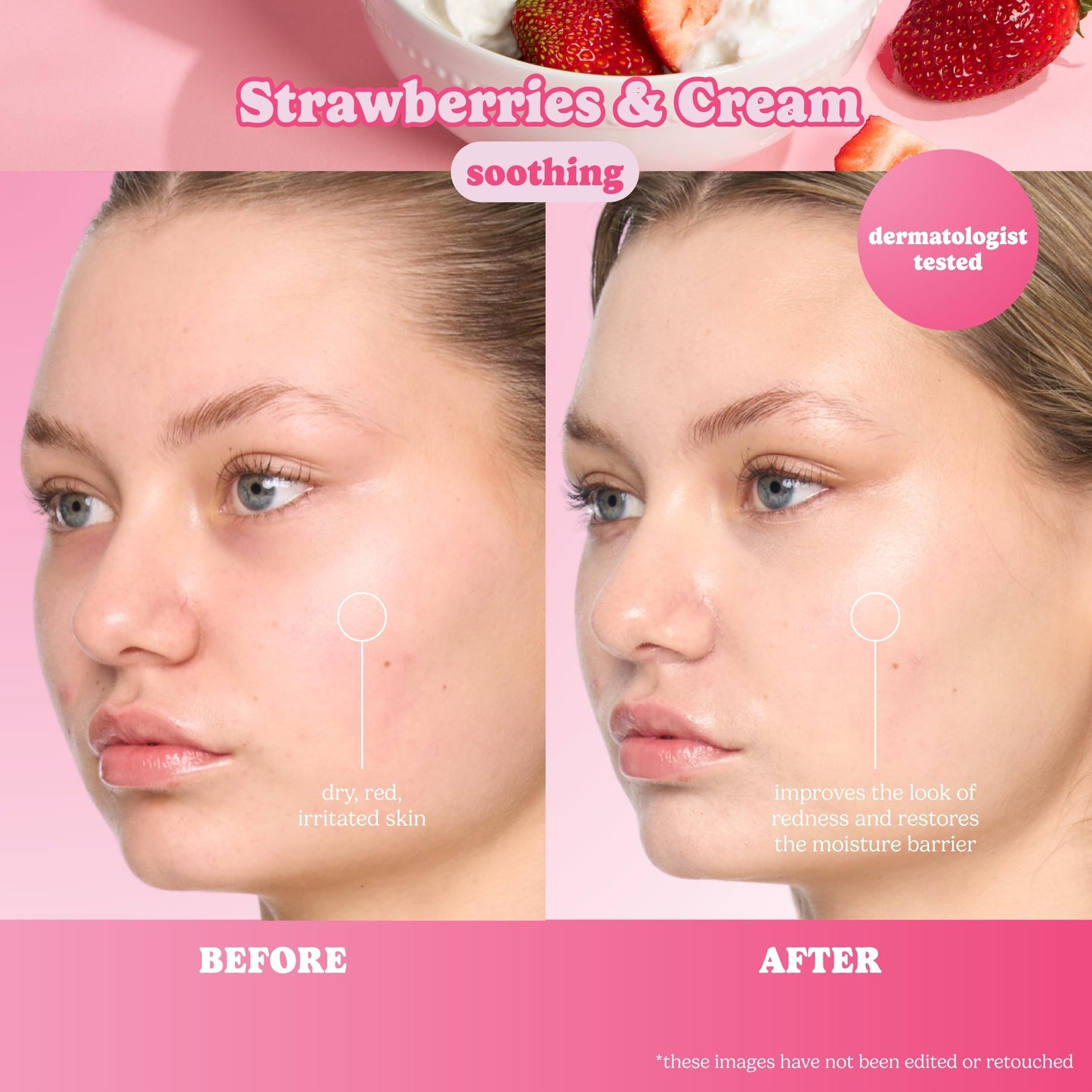 ESW Beauty Strawberries & Cream Soothing Korean Face Mask - Vitamin C, Centella & Vitamin E for Sensitive Skin, Hydration & Barrier Support - Skincare