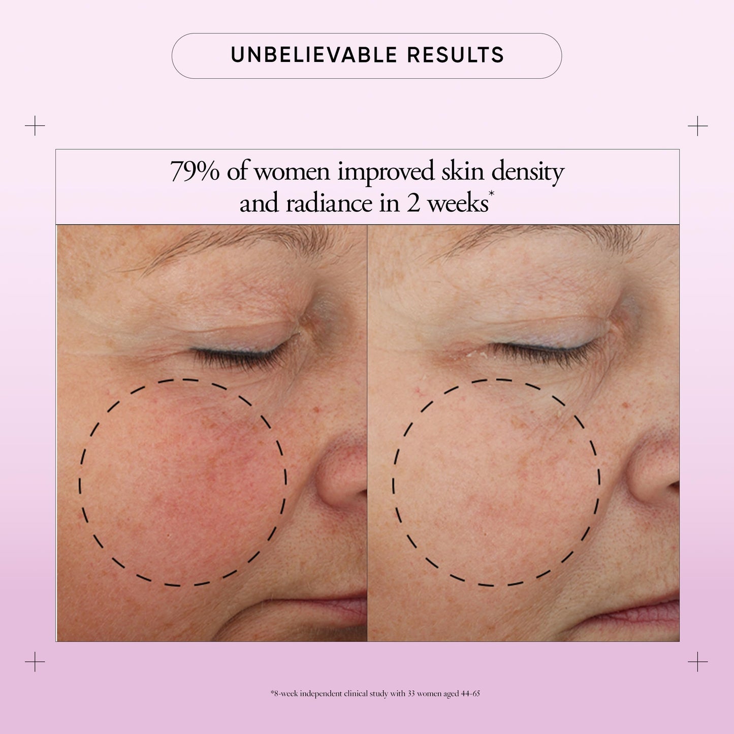 philosophy ultimate miracle worker multi-rejuvenating face moisturizer cream + spf 30 - with encapsulated retinol - delivers firmer, youthful looking