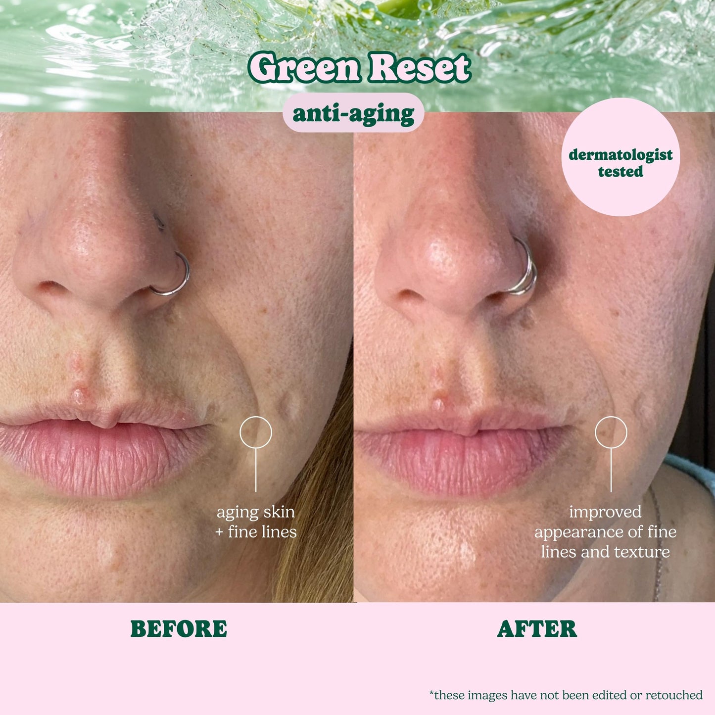 ESW Beauty Green Reset Anti-Aging Korean Face Mask - Vitamin C, Hyaluronic Acid & Kale for Collagen Support, Smooth Skin & Hydration - Skincare Gifts