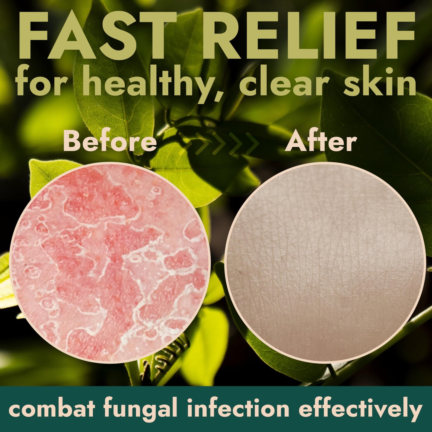 Antifungal Soap | Medicated Jock Itch Treatment, Fights Ringworm & Athlete's Foot | Soothing Tea Tree & Eucalyptus | 1% Tolnaftate for Effective Beauty and Personal Care Terramed Just Think Comfort