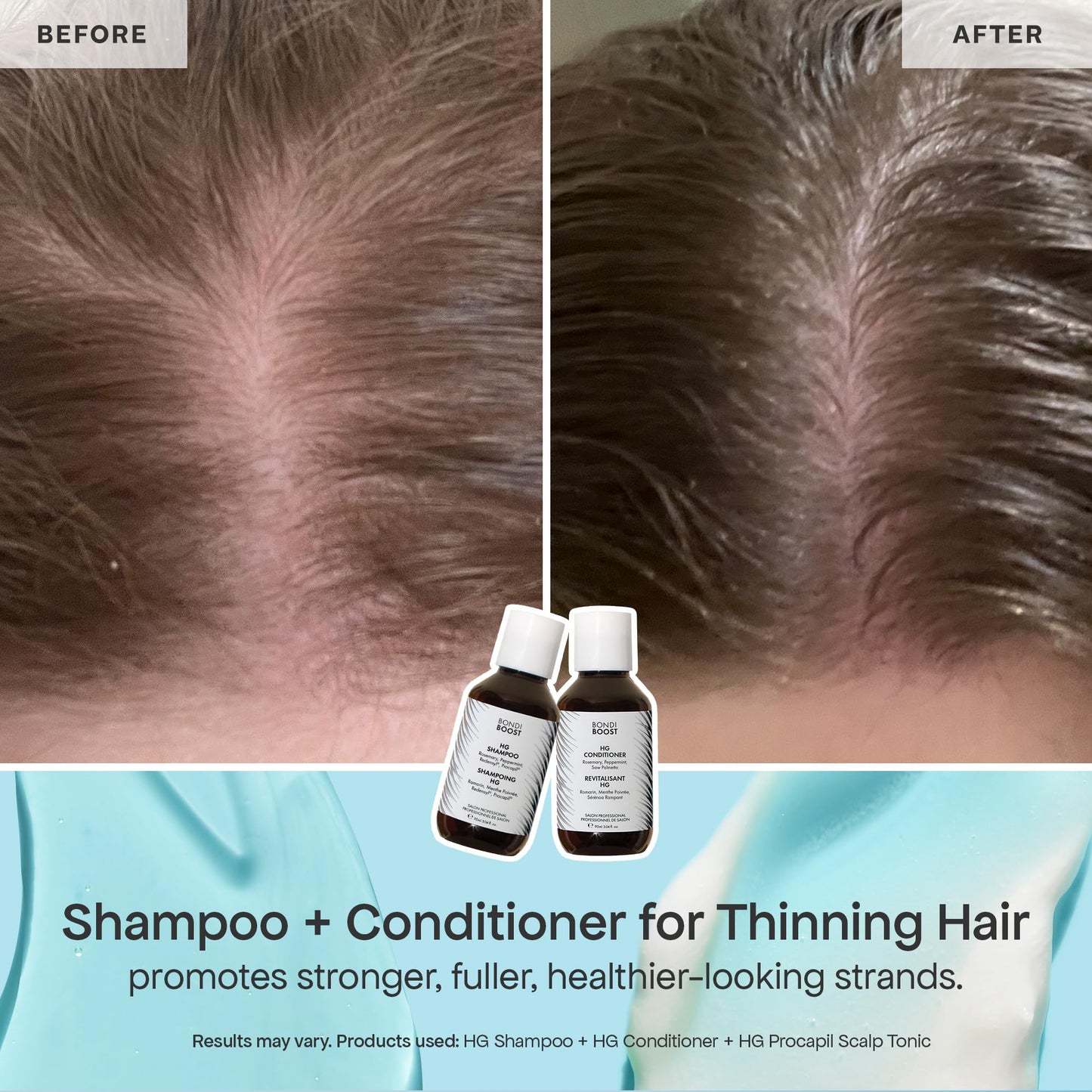 BondiBoost Shed Happens Anti-Thinning Hair Trio - HG Shampoo + Conditioner (90ML) + Lock Drops Serum (30ML) - Reduces Shedding, Supports Fuller