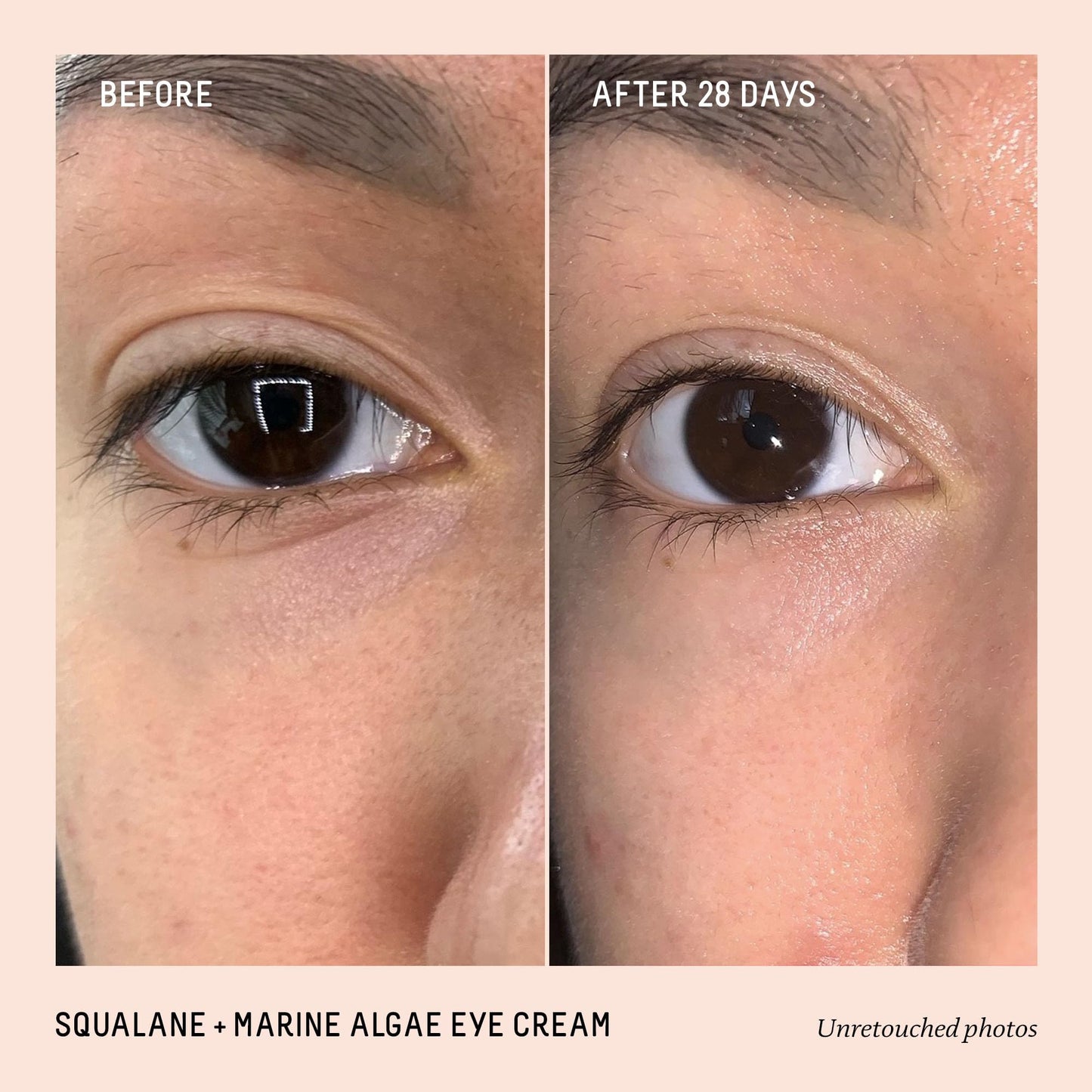 BIOSSANCE Squalane and Marine Algae Eye Cream - Anti-Aging Under Eye Cream for Fine Lines, Wrinkles, and Puffiness - Hydrating & Lifting Formula