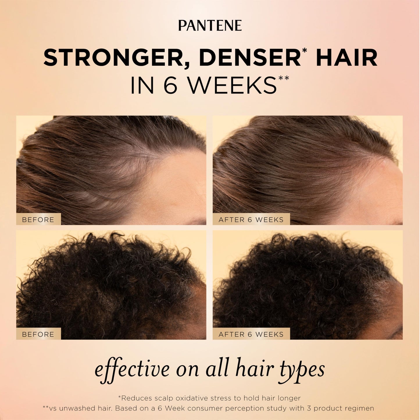 Pantene Abundant & Strong Daily Scalp Serum, Strengthens Scalp’s Hold on Roots, 2 oz Beauty and Personal Care Pantene