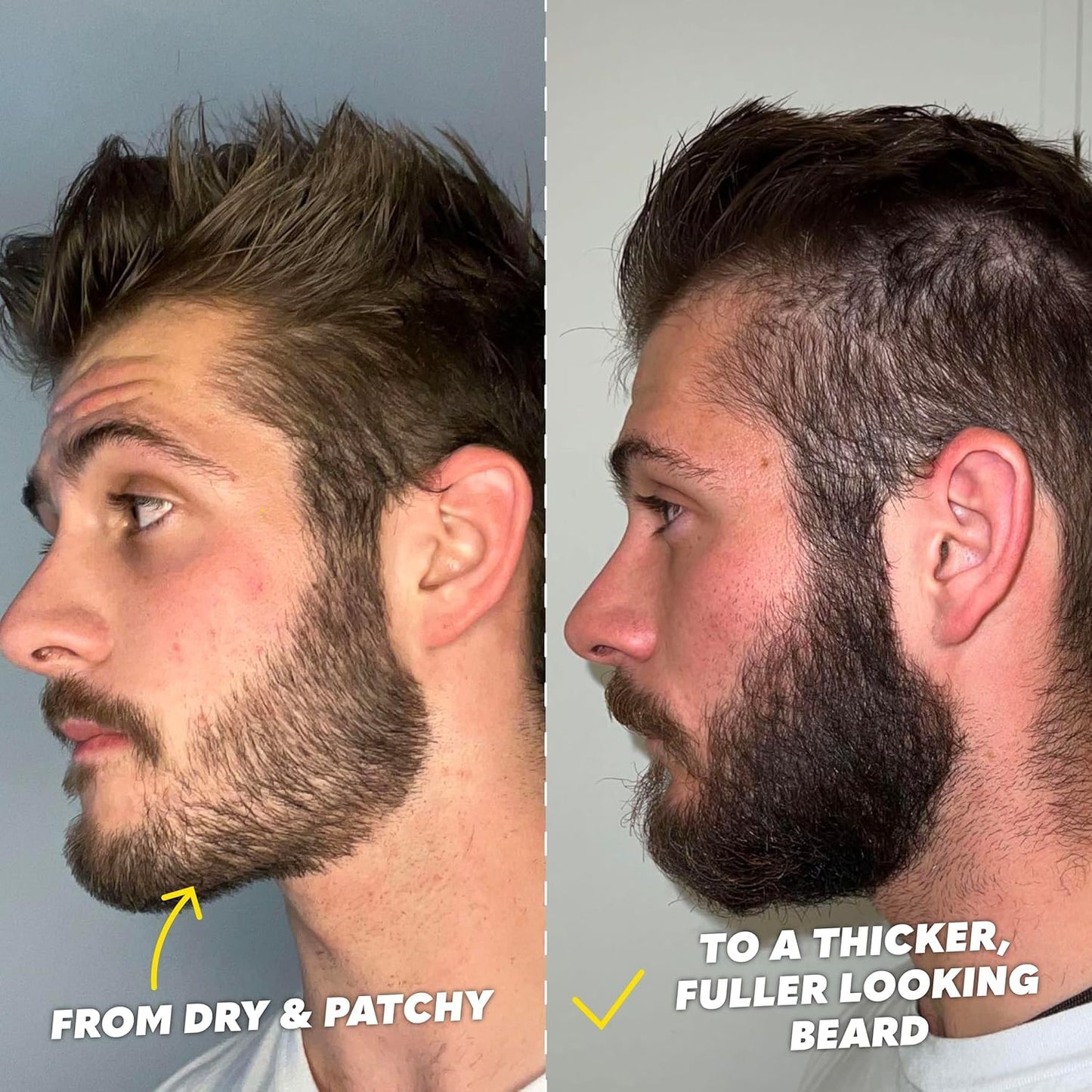 The Beard Club Ultimate Beard Growth Kit - Derma Roller, Growth Oil, Vitamins, Vitamin Spray, Biotin Balm, Conditioner, Cream, Balms, Shampoo, Razor Beauty and Personal Care The Beard Club