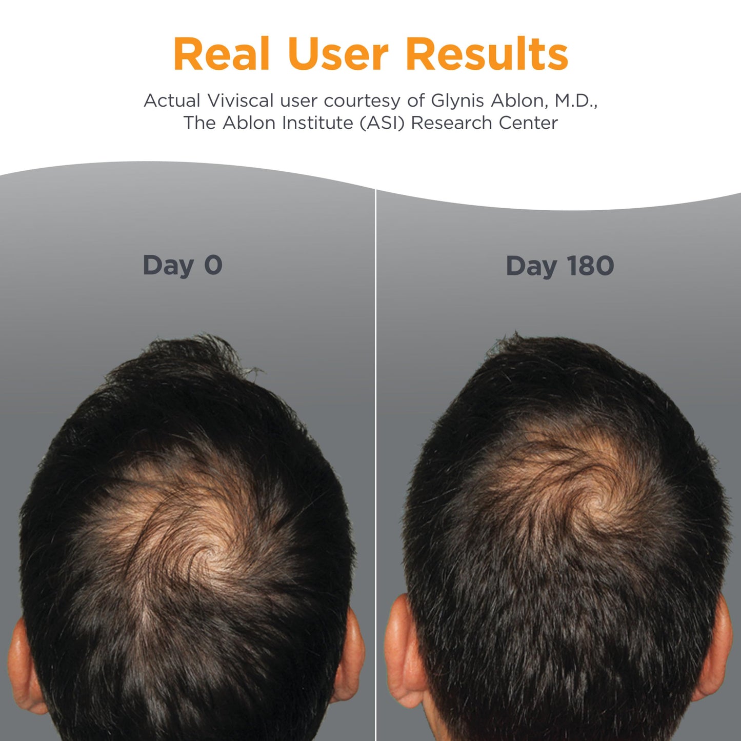 Viviscal Men's Hair Growth Supplements for Thicker Fuller Hair, Clinically Proven Collagen Complex, 180 Tablets 3 Month Supply Beauty and Personal Care Viviscal
