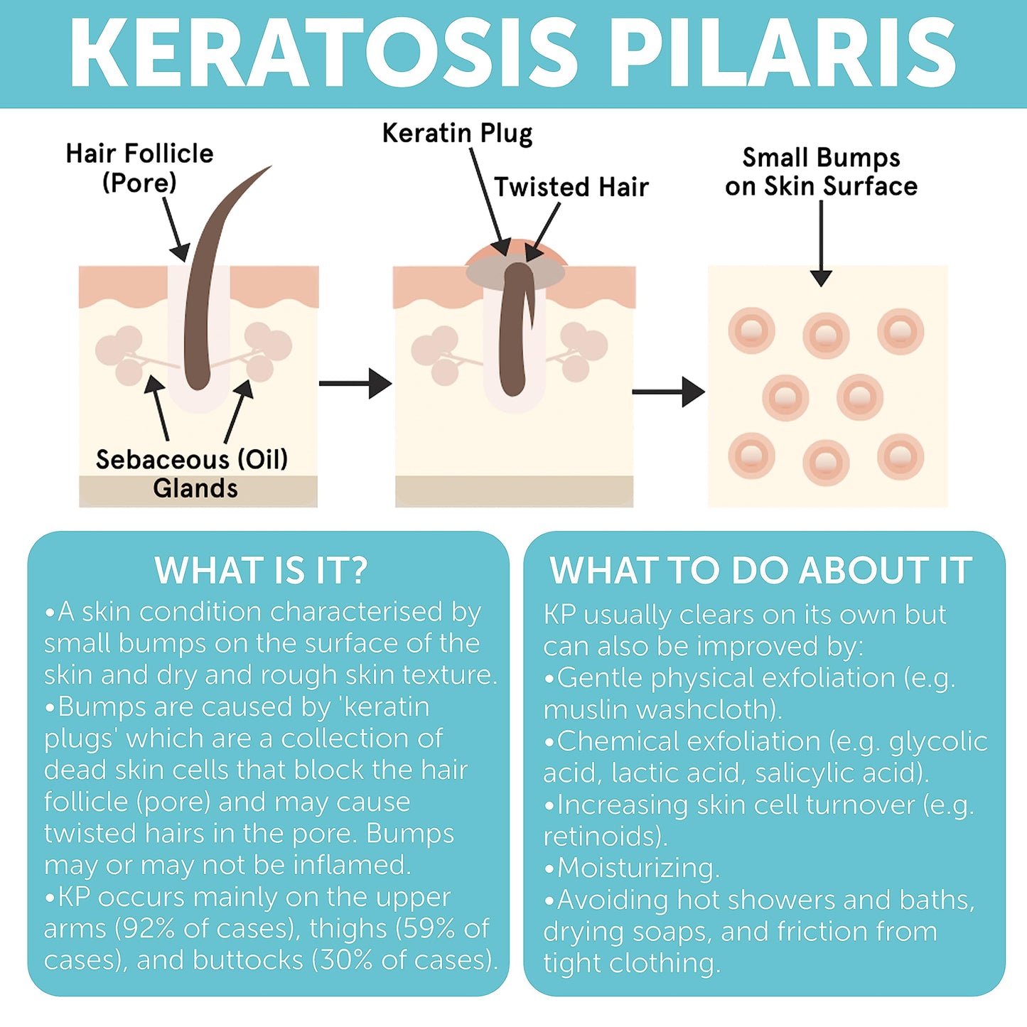 KP Bump Eraser Body Scrub | Exfoliating Body Scrun | Ingrown Hair Treatment | Clears Strawberry Legs | Soothes Redness, Dryness & Flaky Skin