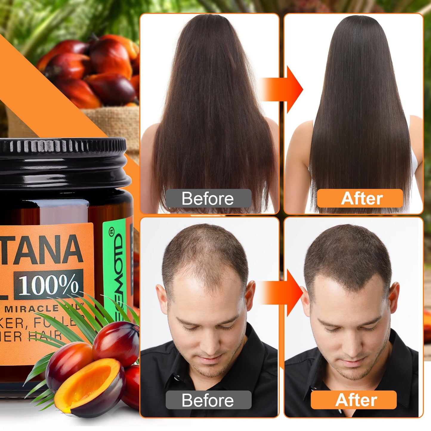 WEEMOTD Unrefined Batana Oil for Hair Growth, Dr. Sebi Raw Batana Oil from Honduras, Hair Mask Hair Growth Oil with Organic and Natural Ingredients (2 Beauty and Personal Care WEEMOTD