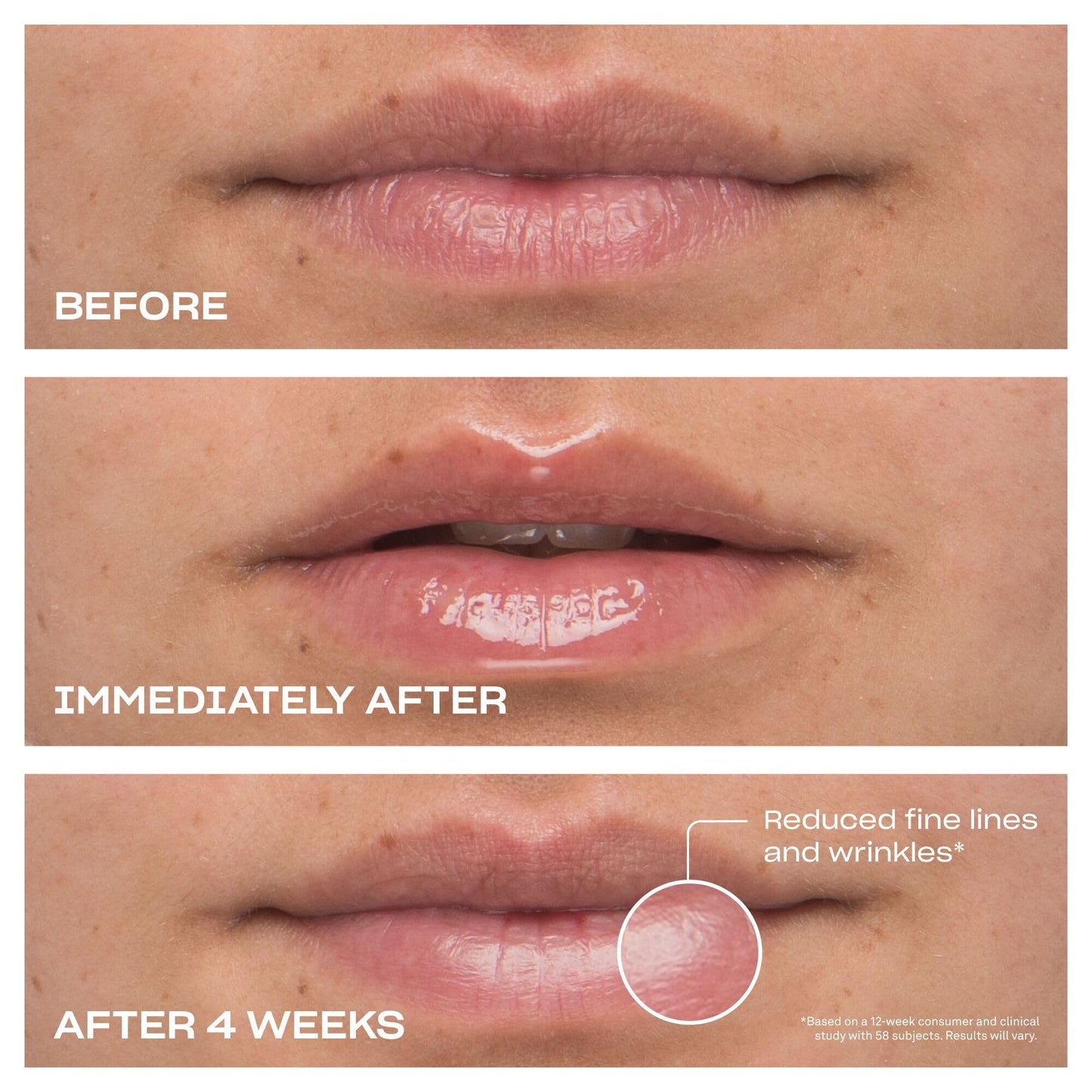 BABE ORIGINAL Cloud 9 Peptide Lip Serum | Daily Lip Treatment with Cloudberry Oil, Mushroom Extracts, Hyaluronic Acid for Dryness & Fine Lines |