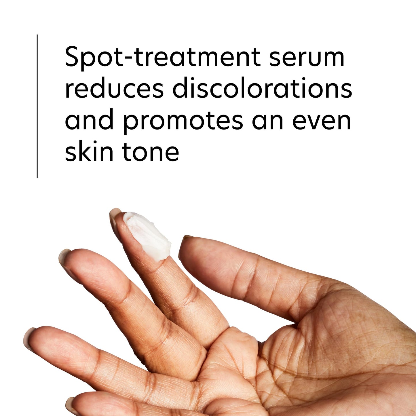 PCA SKIN Hydroquinone-Free Pigment Gel Dark Spot Corrector, Dark Spot Serum for Brightening Dark Spots and Hyperpigmentation, Helps Even Skin Tone