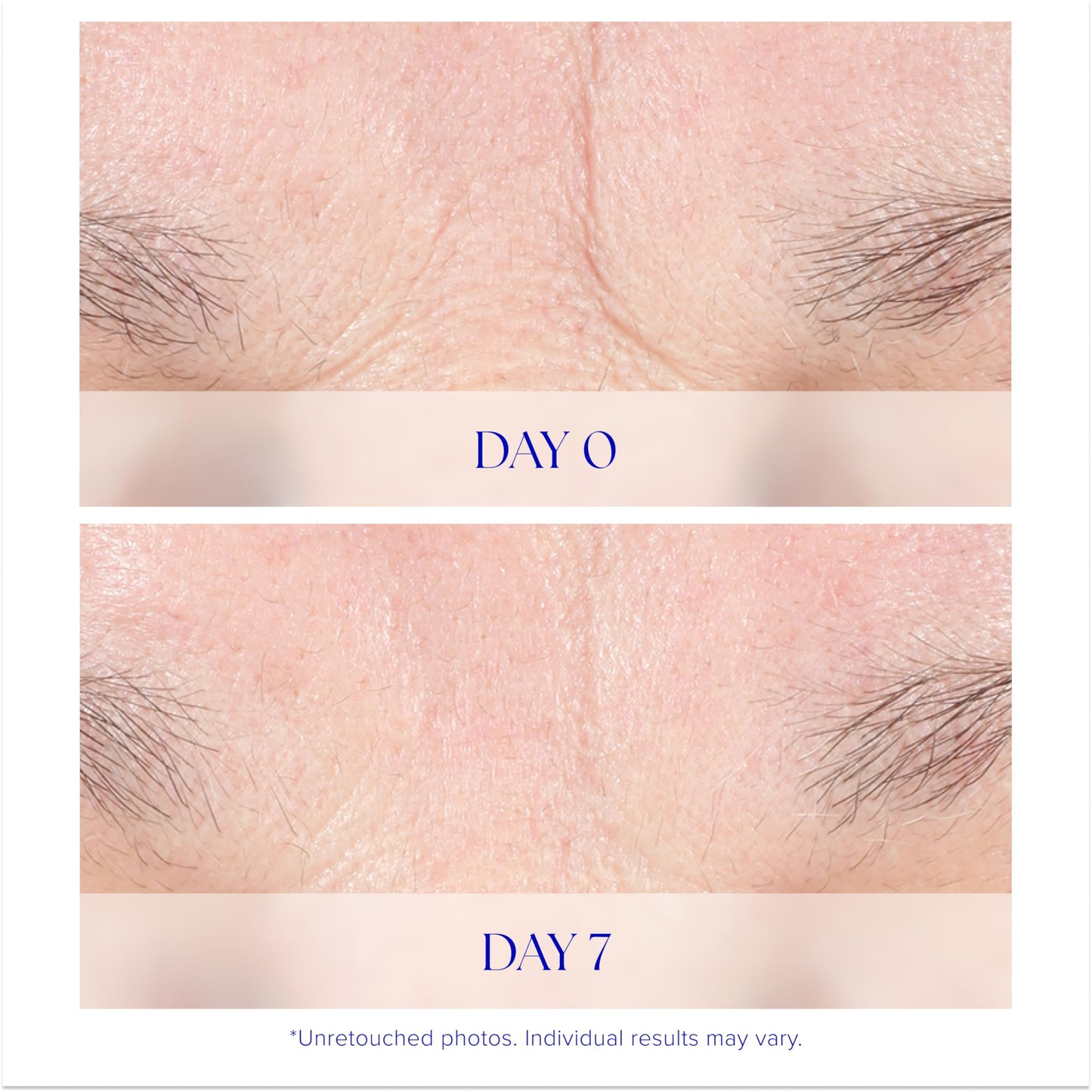 iS CLINICAL Youth Intensive Crème. Anti-aging, firming face cream. Reduces appearance of fine fines and wrinkles