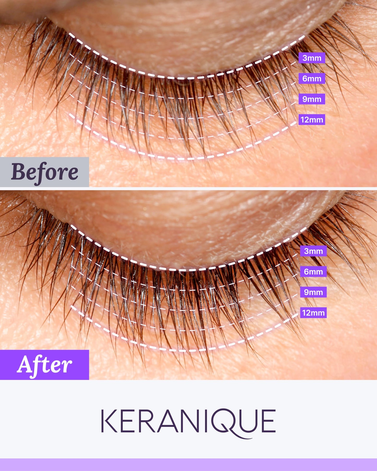 Keranique Lash Growth Serum - Eyelash Enhancer for Women with Thin & Brittle Lashes - Intense Boost for Long, Natural Eyelashes