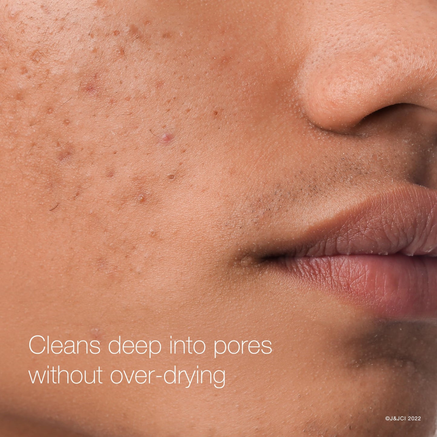 Neutrogena Rapid Clear Maximum Strength Acne Face Pads with 2% Salicylic Acid Acne Medication to Help Fight Breakouts, Oil-Free Facial Cleansing Pads