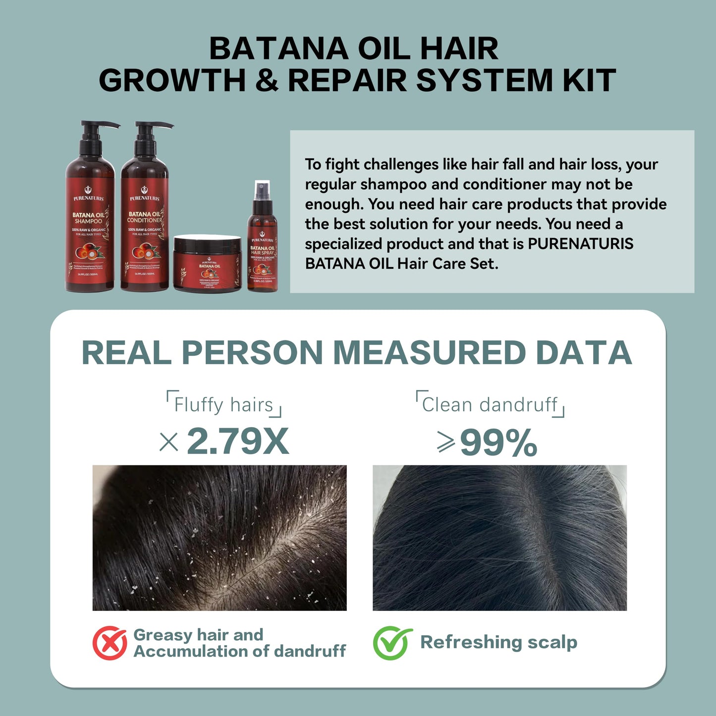 100% Natural Raw Organic Batana Oil Sulfate-Free Complete Hair Growth , Anti-Hair Loss & Repair System Kit - Shampoo, Conditioner, Hair Mask