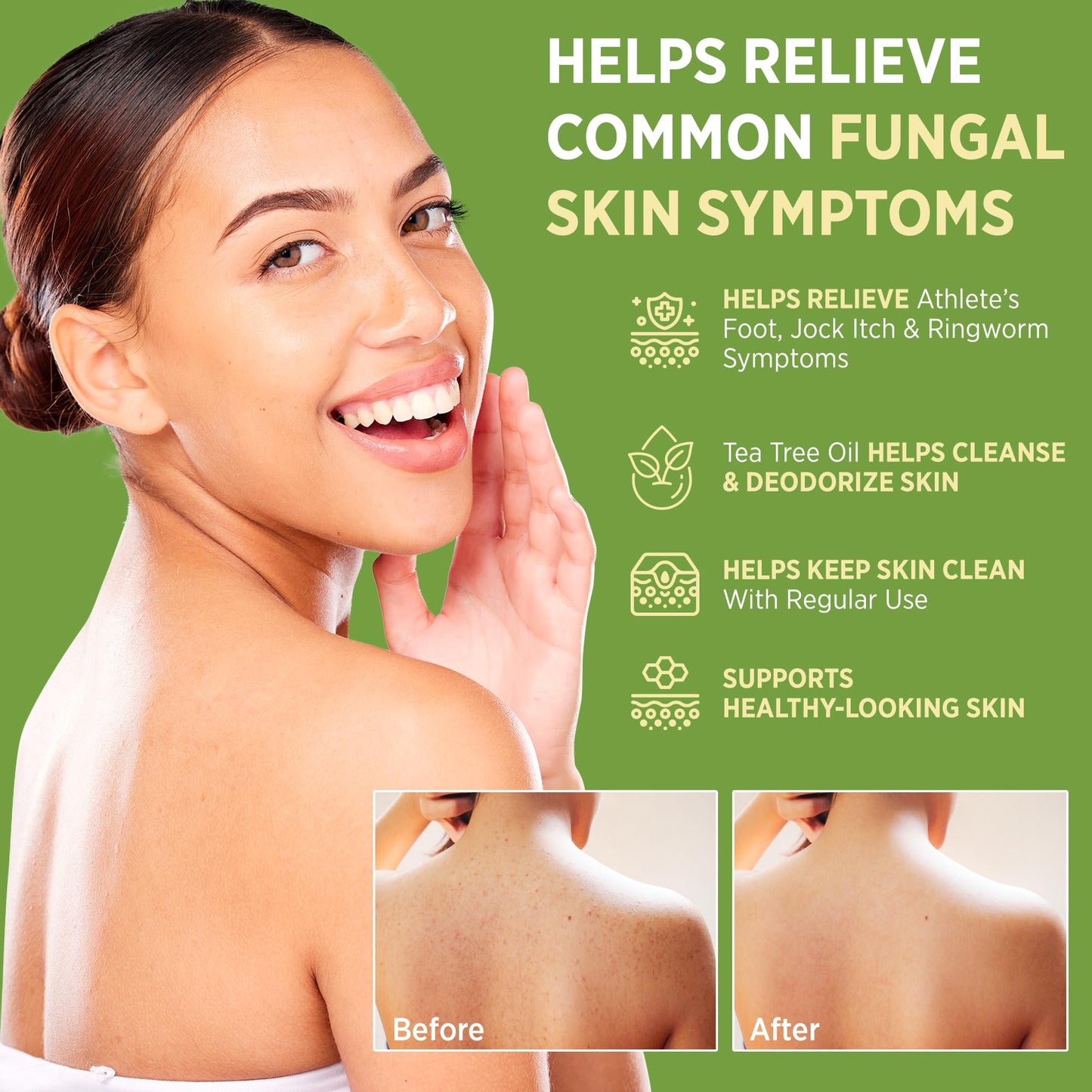 Roycederm Antifungal Bar Soap - Tea tree Oil Soap - Athlete’s Foot Treatment for Jock Itch & Ringworm - Medicated Antifungal Soap with Clotrimazole 1% Beauty & Personal Care Roycederm