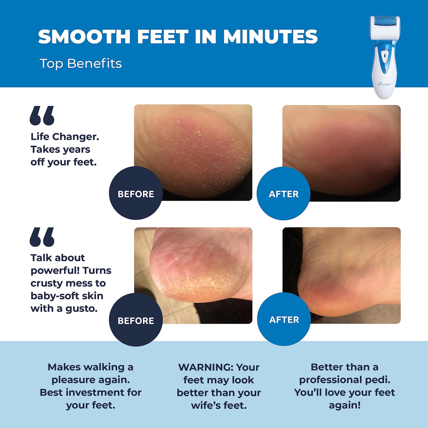 Electric Callus Remover: Own Harmony Professional Pedicure Tools Foot Care for Women, Rechargeable Foot Scrubber, CR900 Electronic Feet File Pedi